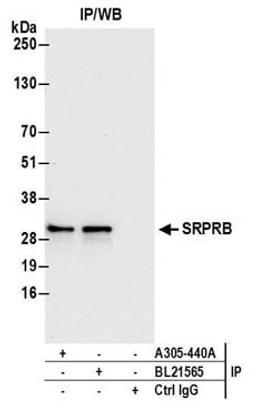 Detection of human SRPRB by western blot of immunoprecipitates.