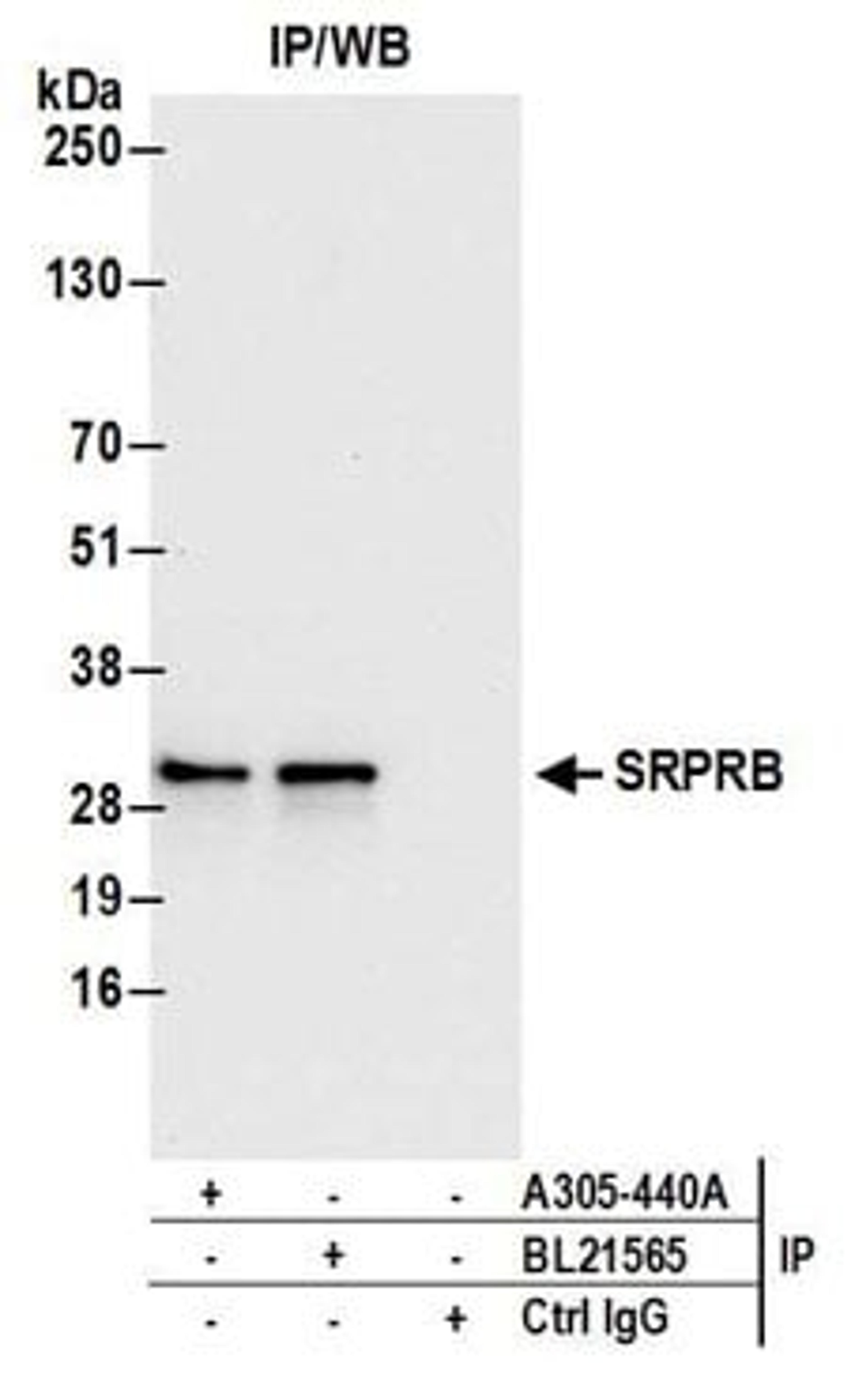 Detection of human SRPRB by western blot of immunoprecipitates.