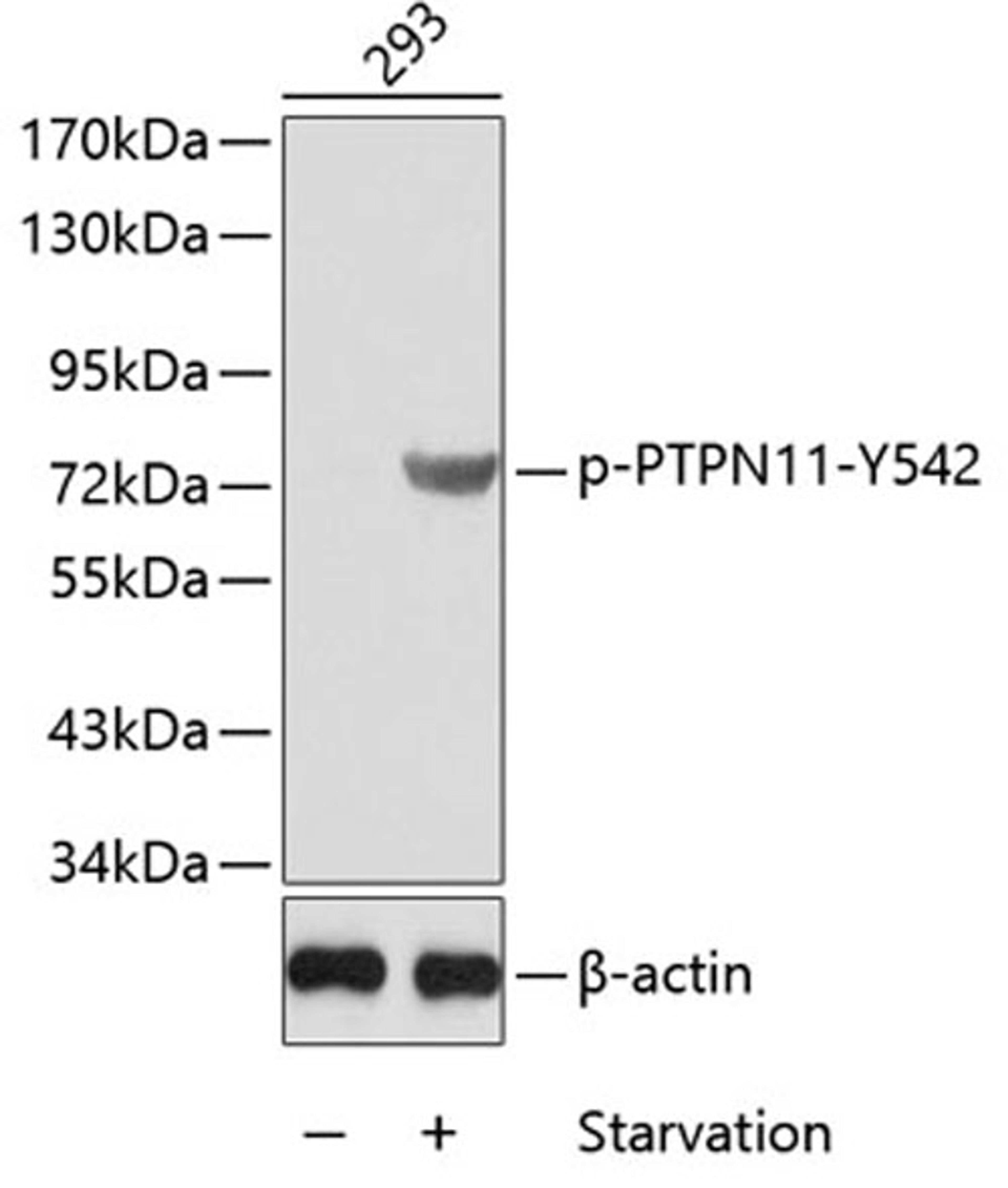 Western blot - Phospho-PTPN11-Y542 antibody (AP0267)