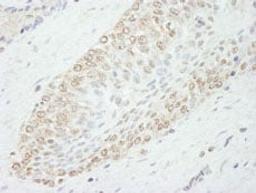 Detection of human WDR91 by immunohistochemistry.