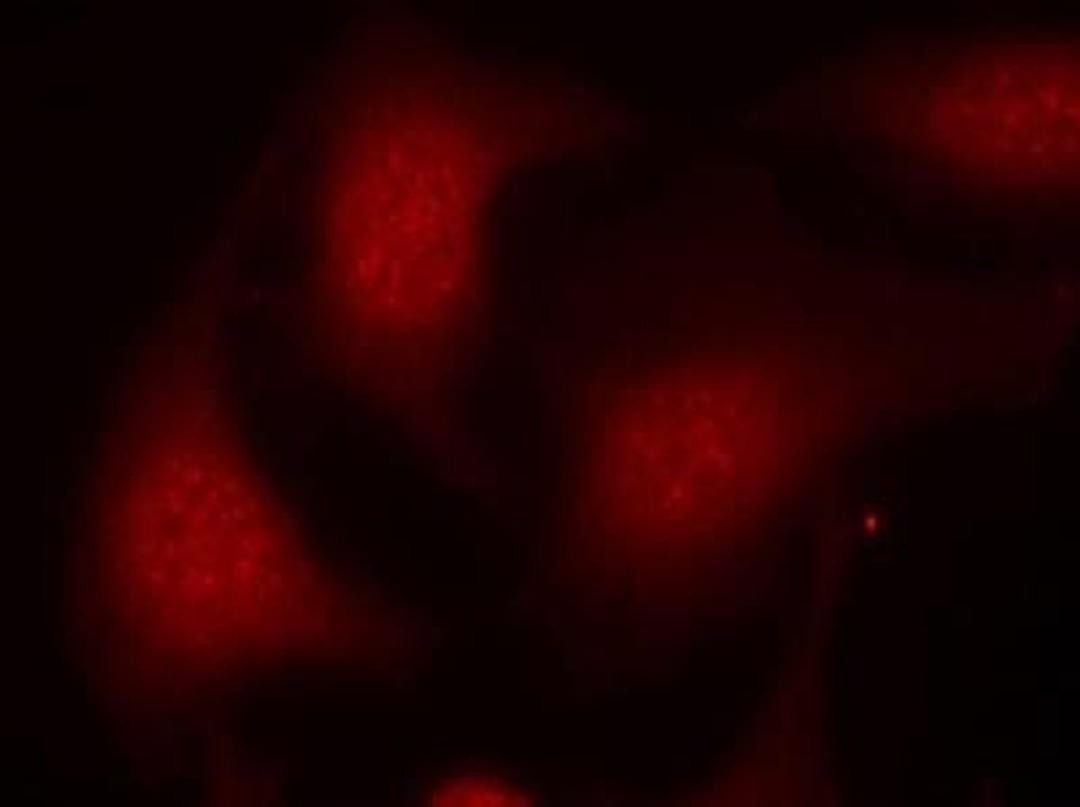 Immunocytochemistry/Immunofluorescence: RB1 [p Ser795] Antibody [NB100-82176] - Staining of methanol-fixed Hela cells using Rb1 (P Ser795) antibody