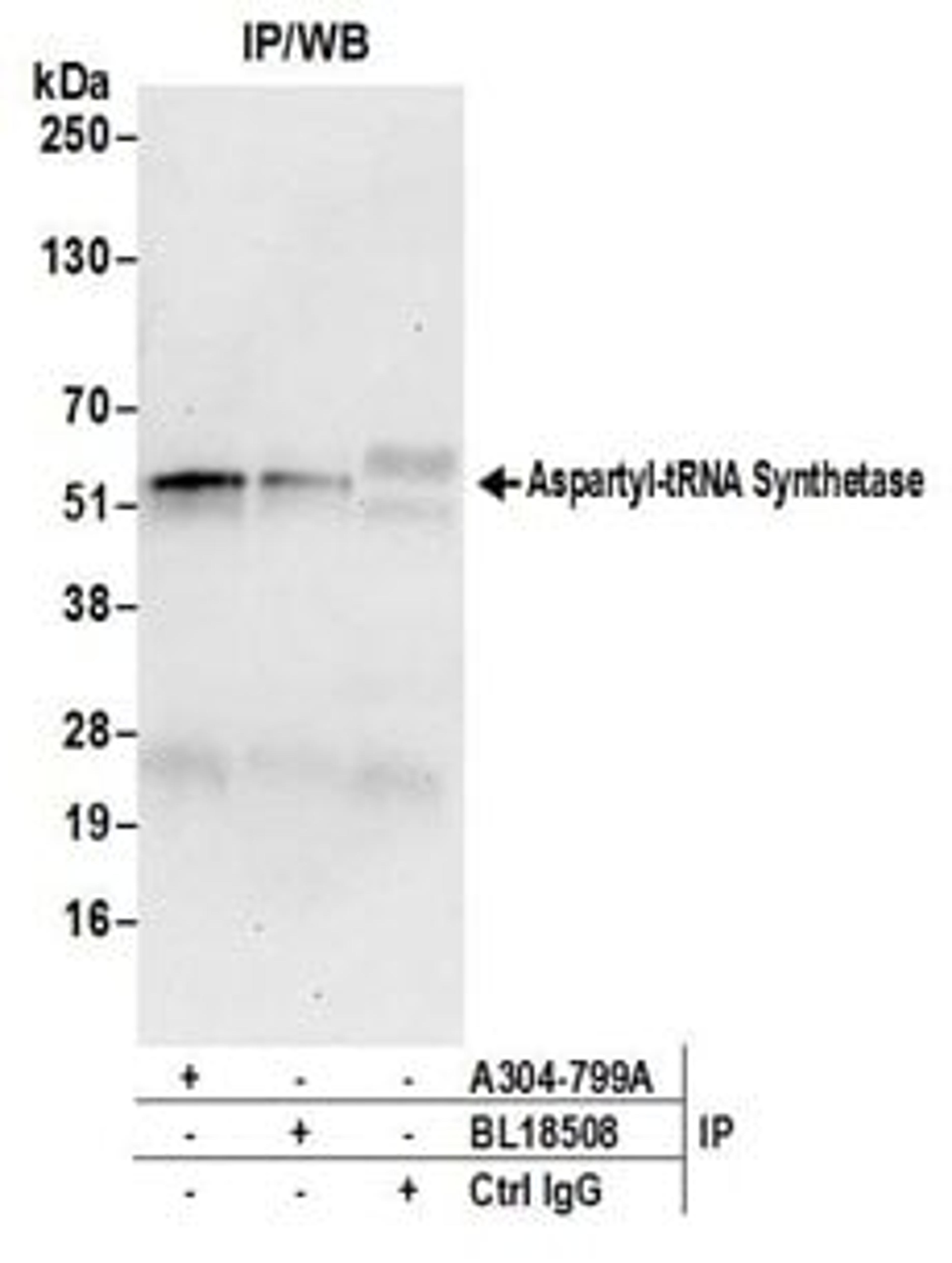 Detection of human Aspartyl-tRNA Synthetase by western blot of immunoprecipitates.