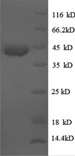 (Tris-Glycine gel) Discontinuous SDS-PAGE (reduced) with 5% enrichment gel and 15% separation gel.