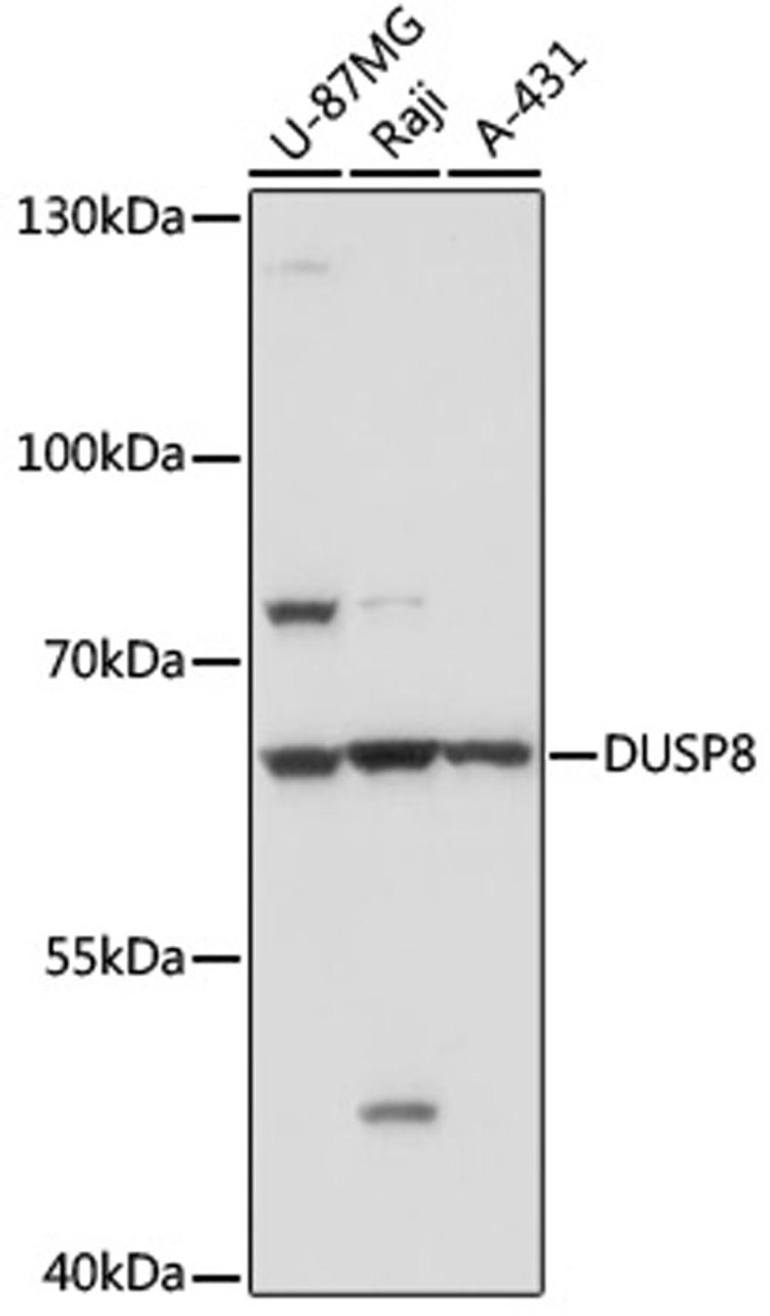 Western blot - DUSP8 antibody (A17990)