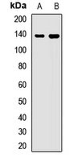 Western blot analysis of HL60 (Lane1), HepG2 (Lane2) whole cell lysates using WDR11 antibody