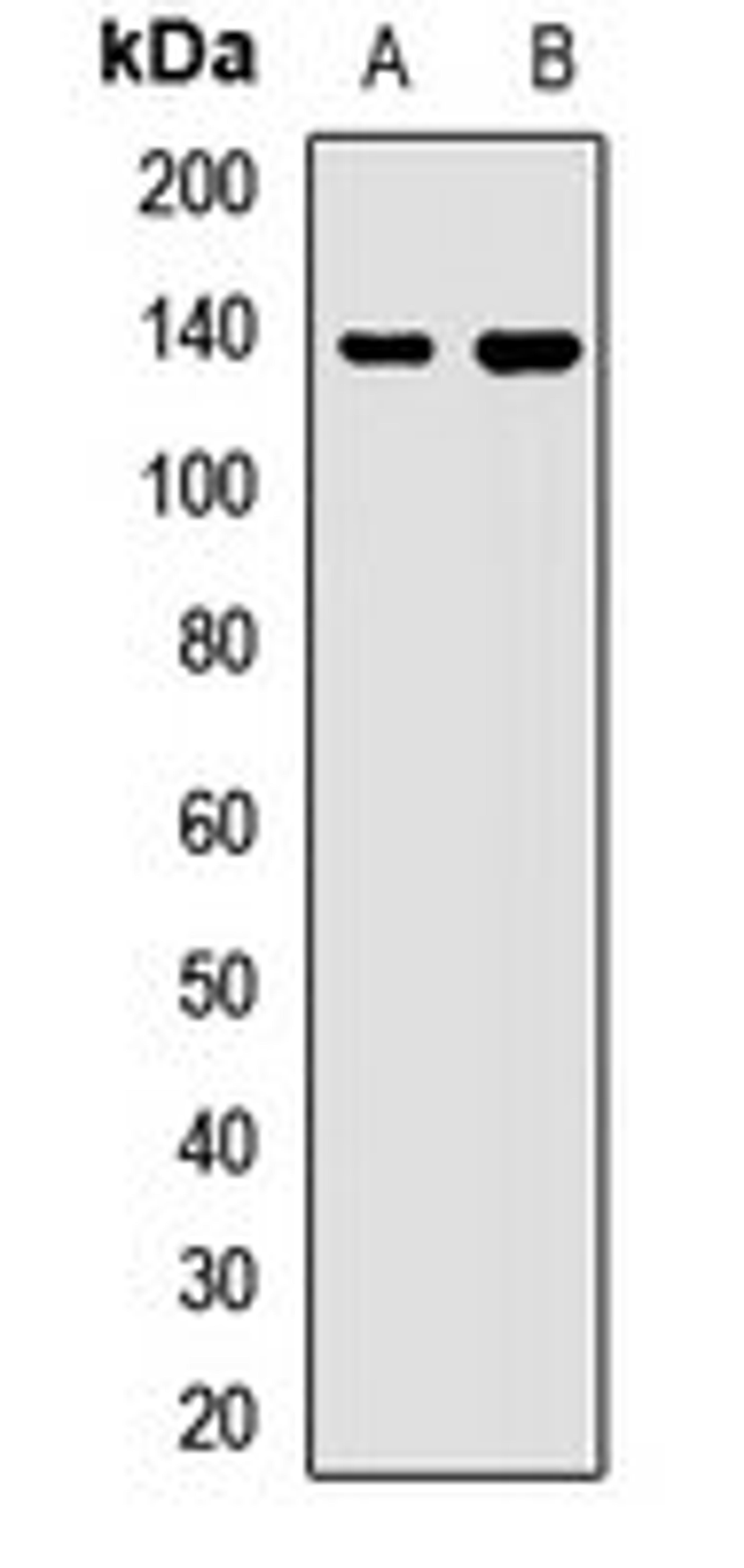 Western blot analysis of HL60 (Lane1), HepG2 (Lane2) whole cell lysates using WDR11 antibody