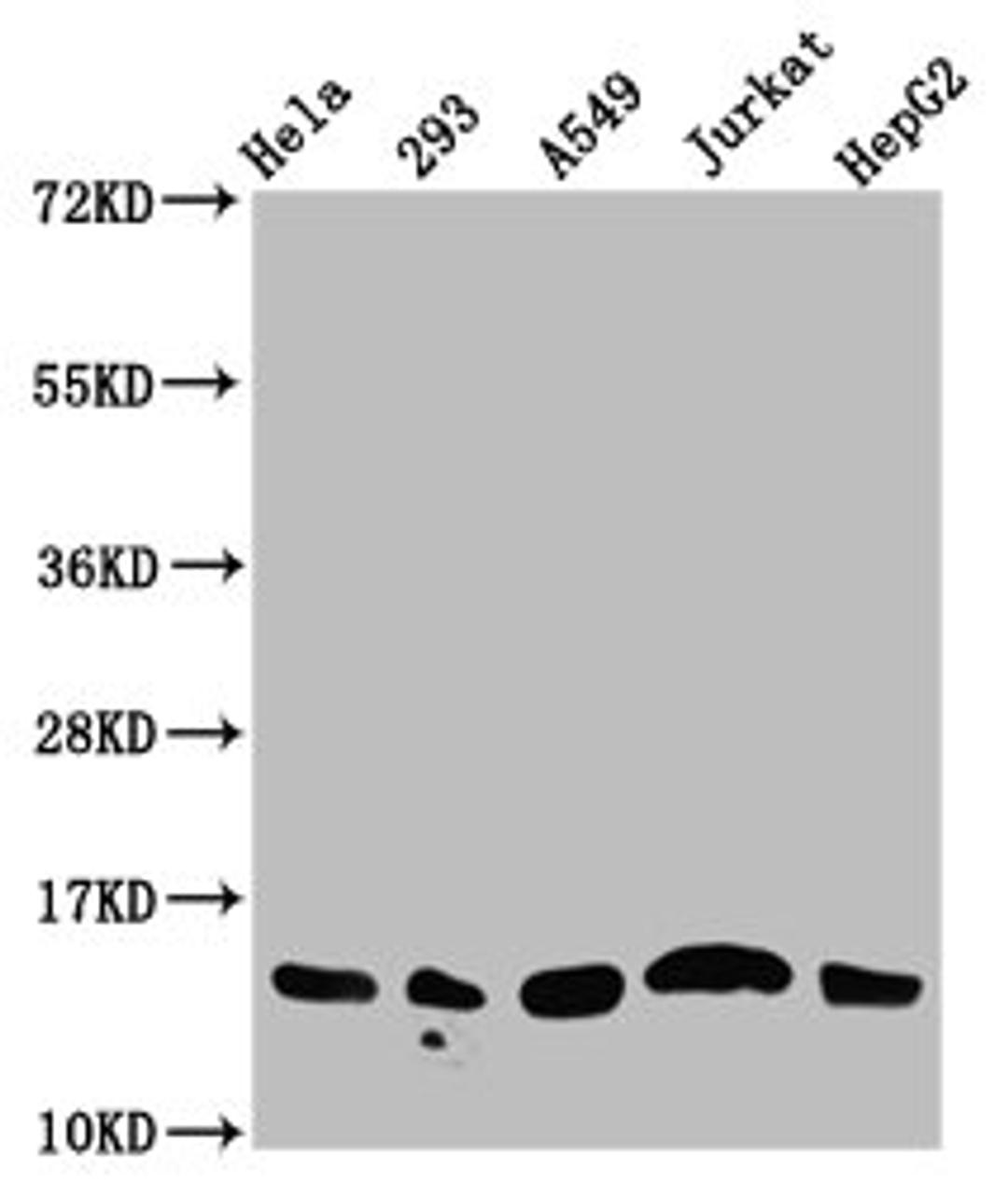 Western Blot. Positive WB detected in: Hela whole cell lysate, 293 whole cell lysate, A549 whole cell lysate, Jurkat whole cell lysate, HepG2 whole cell lysate (all treated with 30mM sodium butyrate for 4h). All lanes: HIST1H2AG antibody at 1.25µg/ml. Secondary. Goat polyclonal to rabbit IgG at 1/50000 dilution. Predicted band size: 15 kDa. Observed band size: 15 kDa