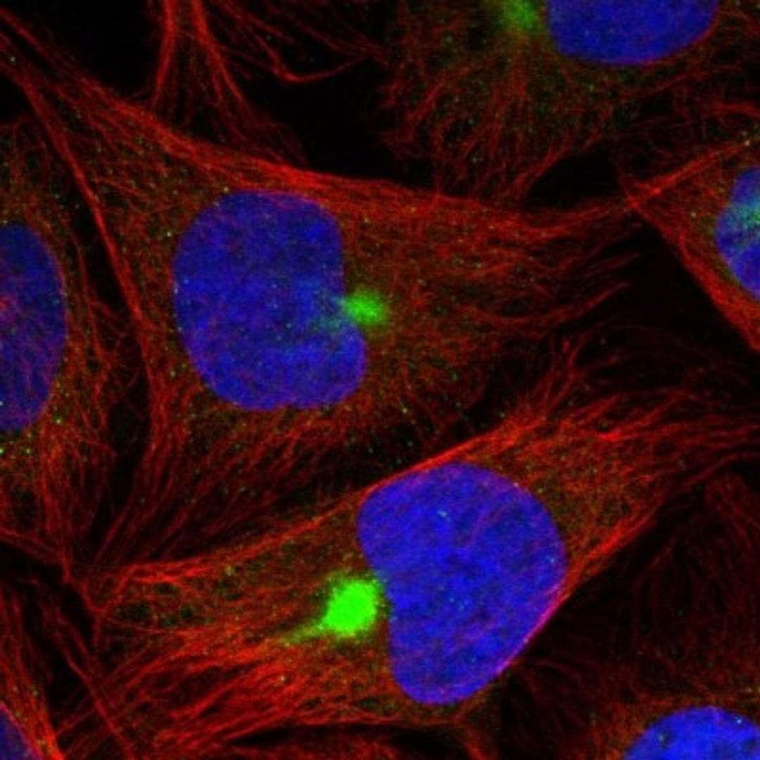 Immunocytochemistry/Immunofluorescence: ZNF189 Antibody [NBP1-85915] - Immunofluorescent staining of human cell line U-2 OS shows positivity in cytoskeleton (intermediate filaments) & aggresome.