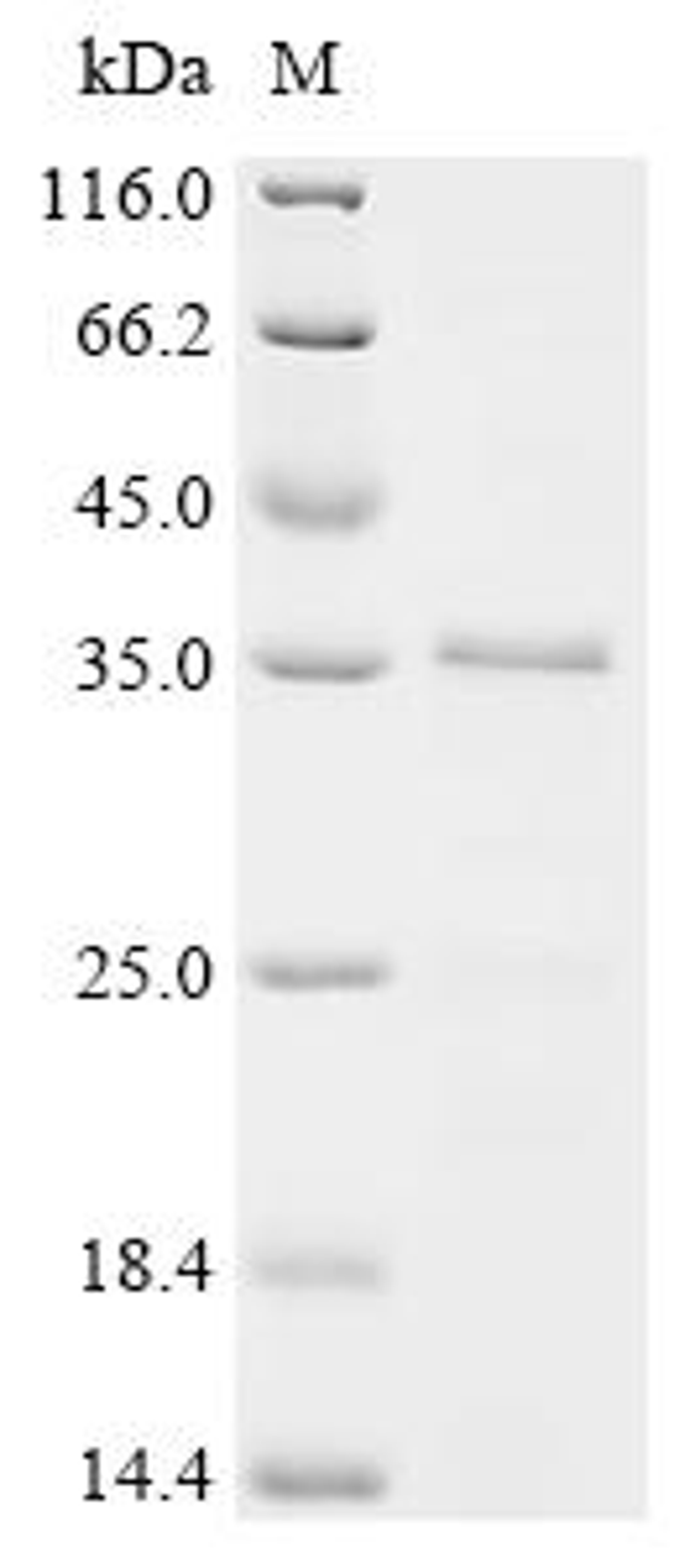 (Tris-Glycine gel) Discontinuous SDS-PAGE (reduced) with 5% enrichment gel and 15% separation gel.