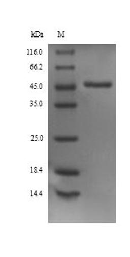 (Tris-Glycine gel) Discontinuous SDS-PAGE (reduced) with 5% enrichment gel and 15% separation gel.