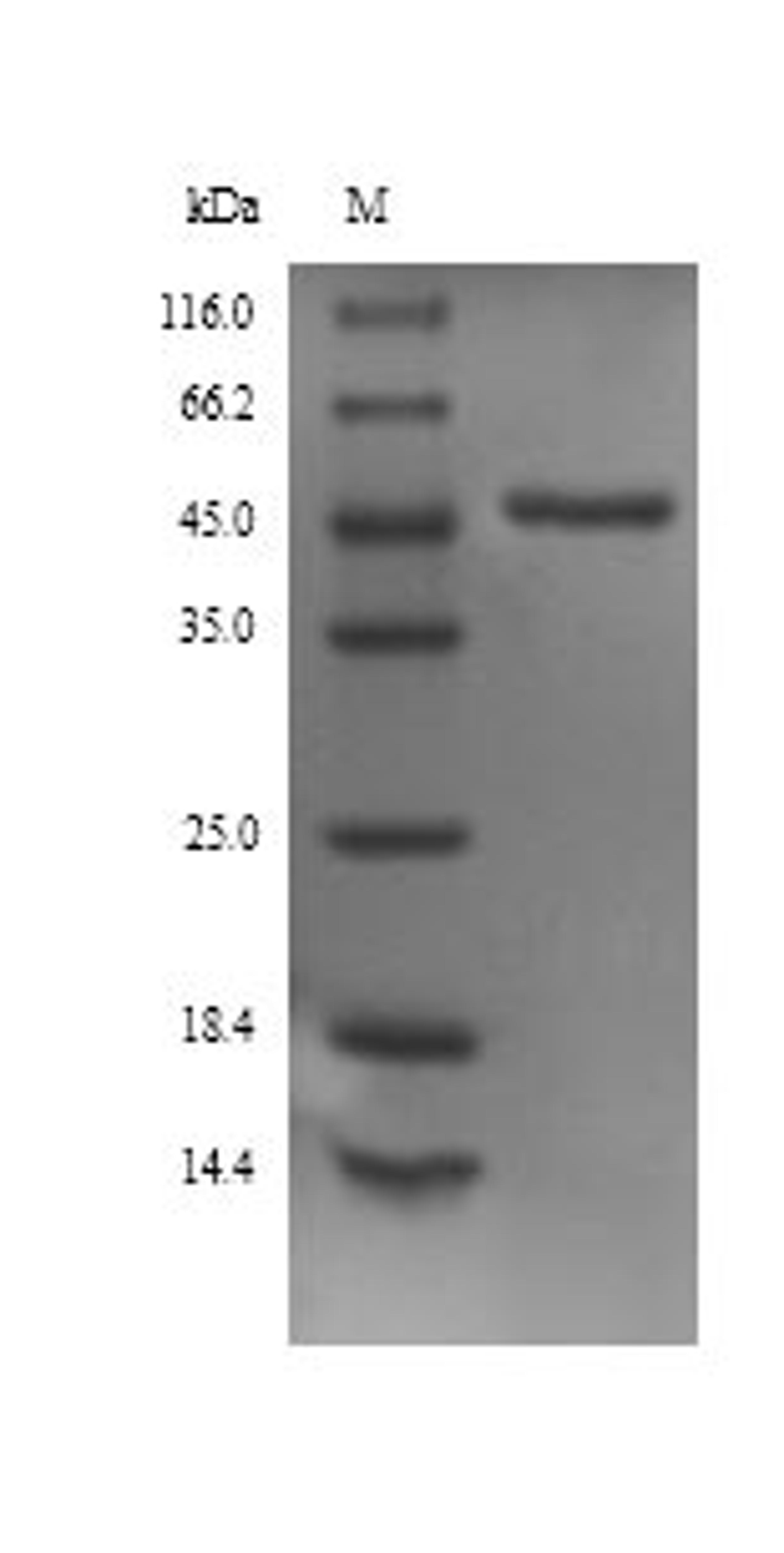 (Tris-Glycine gel) Discontinuous SDS-PAGE (reduced) with 5% enrichment gel and 15% separation gel.