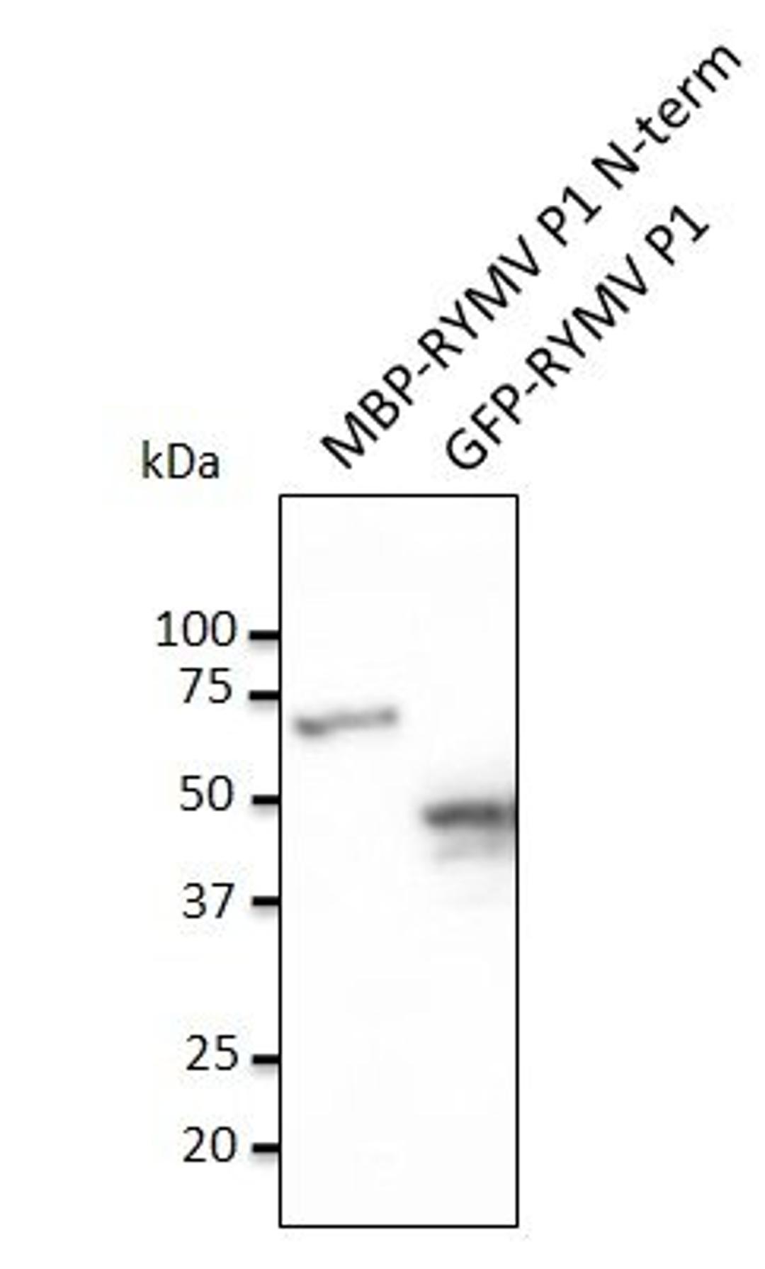 Western blot analysis of staining of MBP-RYMV P1 N-term recombinant protein and HEK293 transfected cell lysate using RYMV P1 antibody