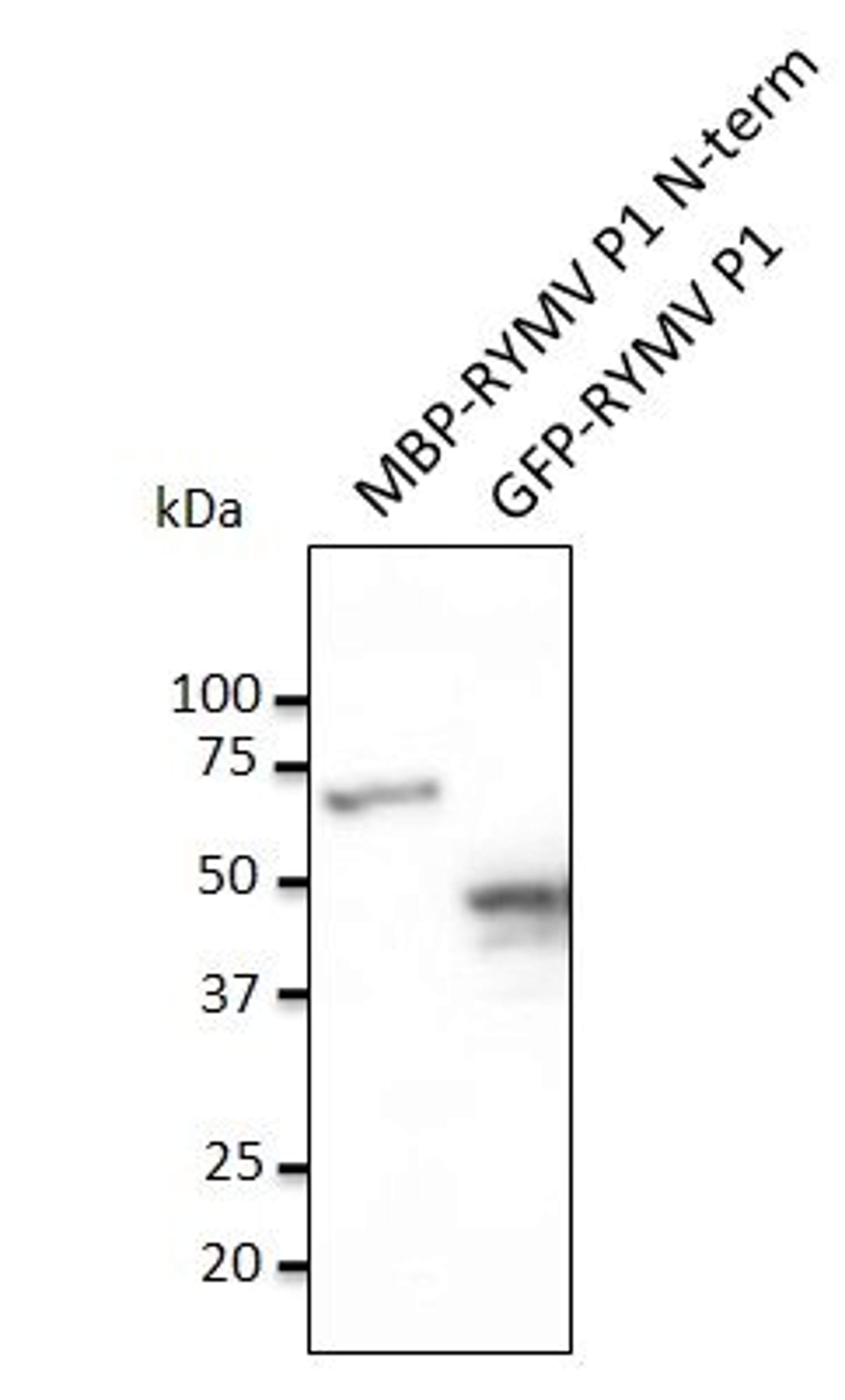 Western blot analysis of staining of MBP-RYMV P1 N-term recombinant protein and HEK293 transfected cell lysate using RYMV P1 antibody