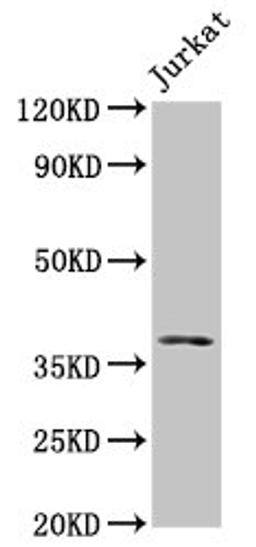 Western Blot. Positive WB detected in: Jurkat whole cell lysate. All lanes: MOS antibody at 5µg/ml. Secondary. Goat polyclonal to rabbit IgG at 1/50000 dilution. Predicted band size: 38 kDa. Observed band size: 38 kDa