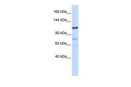 Antibody used in WB on Human HeLa at 0.2-1 ug/ml.