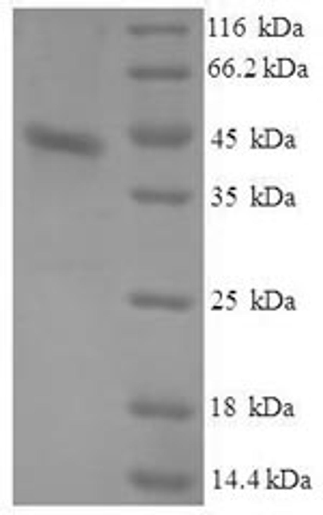 (Tris-Glycine gel) Discontinuous SDS-PAGE (reduced) with 5% enrichment gel and 15% separation gel.