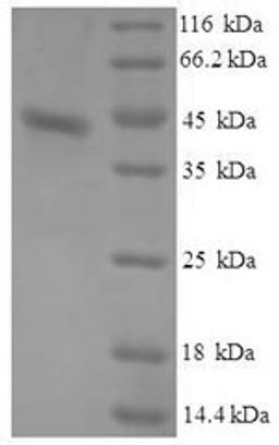 (Tris-Glycine gel) Discontinuous SDS-PAGE (reduced) with 5% enrichment gel and 15% separation gel.
