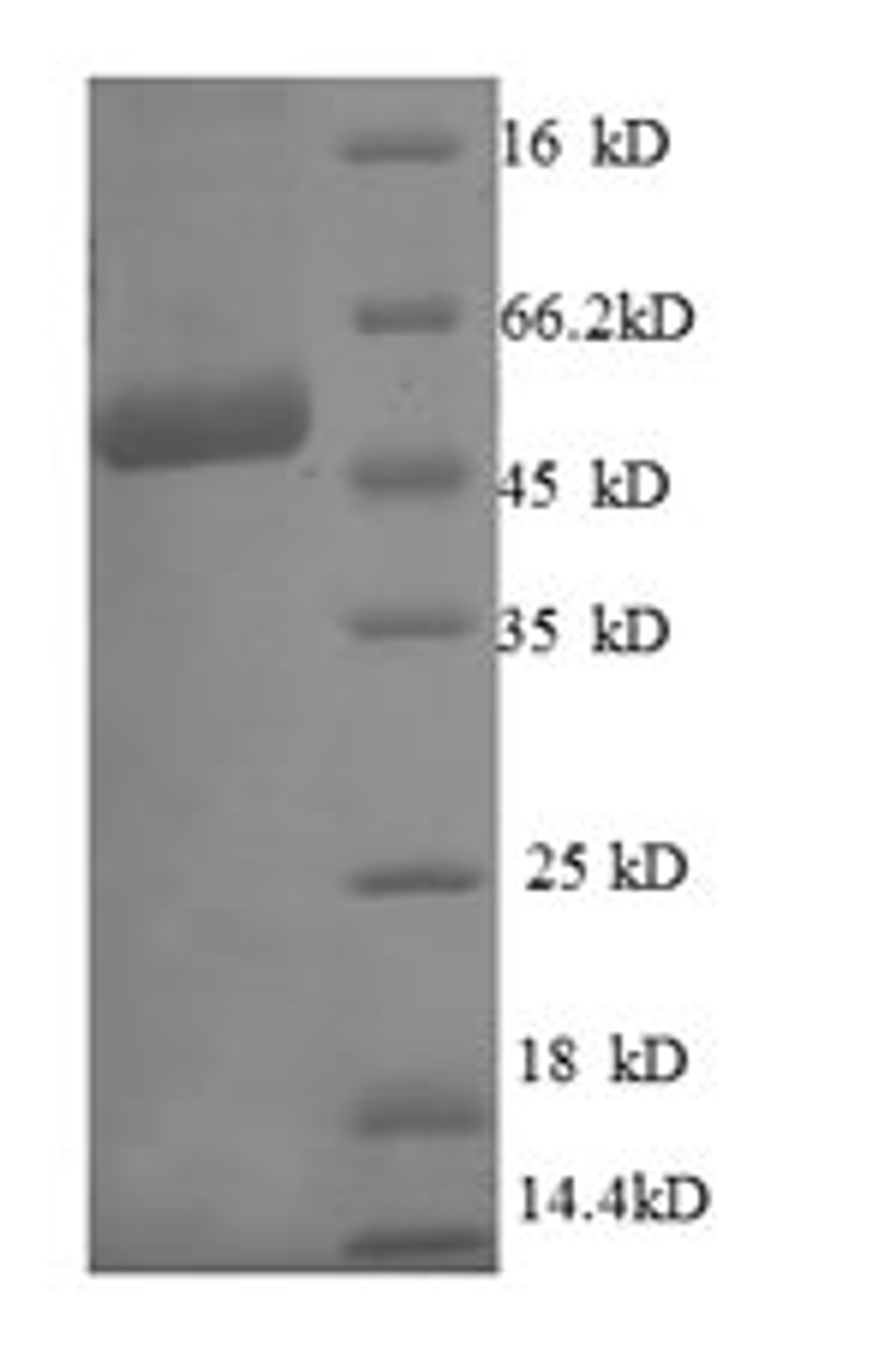 (Tris-Glycine gel) Discontinuous SDS-PAGE (reduced) with 5% enrichment gel and 15% separation gel.