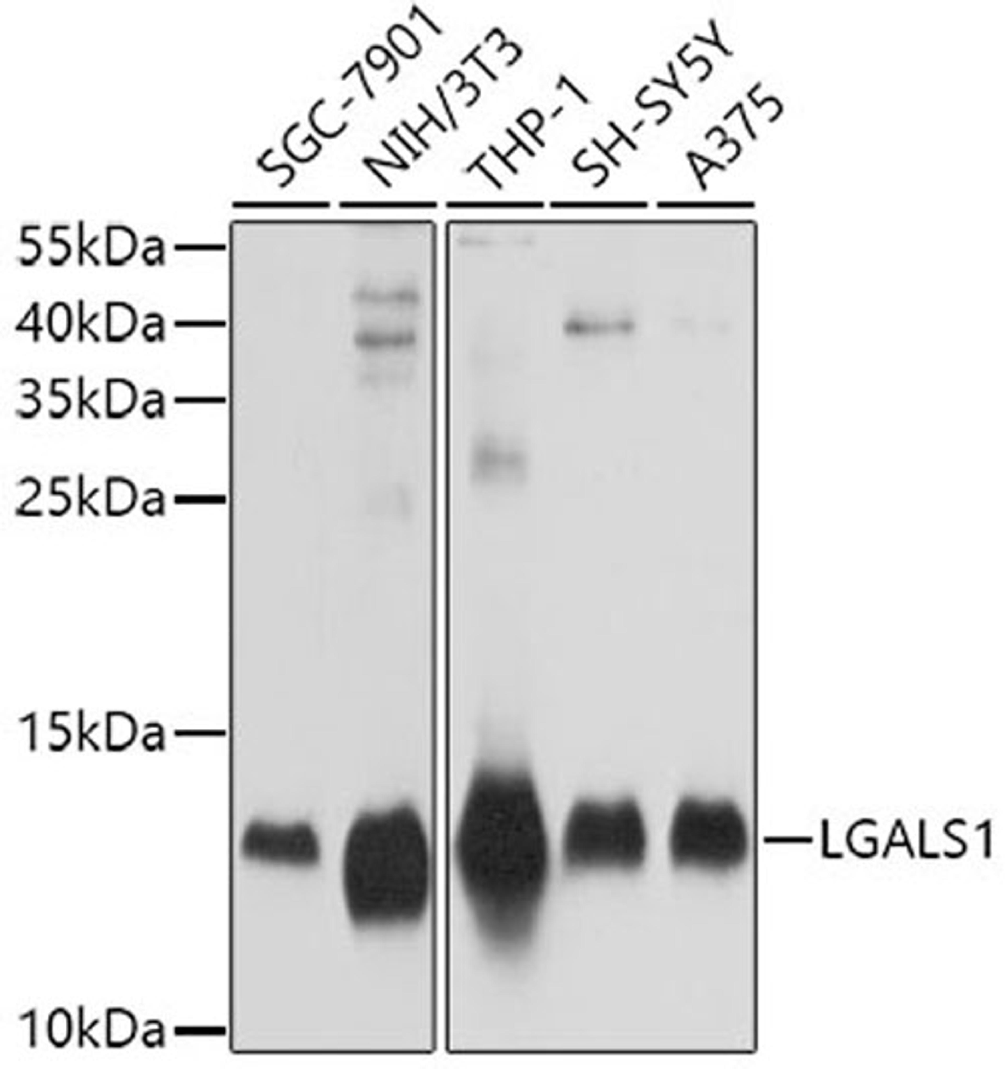 Western blot - LGALS1 antibody (A1580)