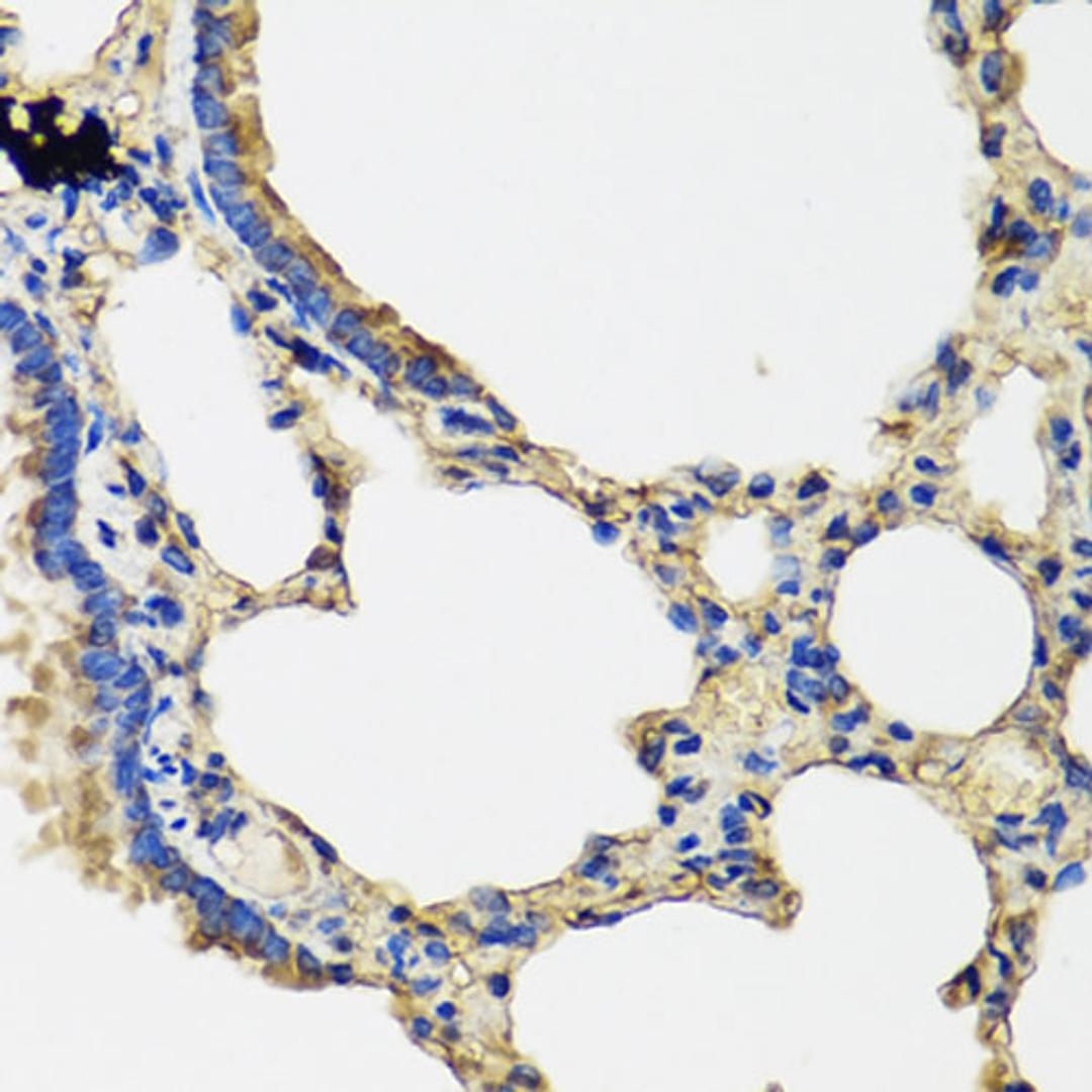 Immunohistochemistry - IL36G antibody (A8304)