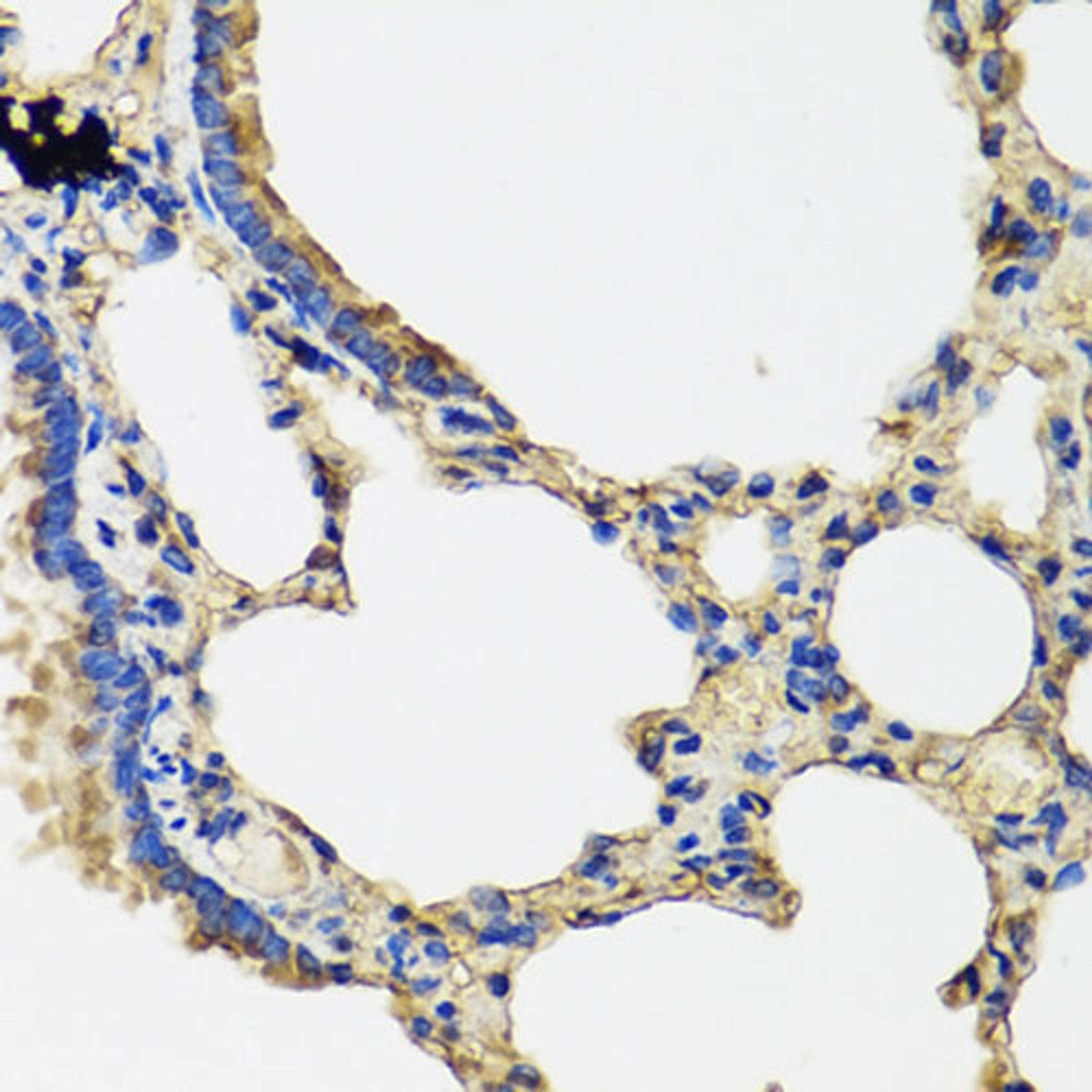 Immunohistochemistry - IL36G antibody (A8304)