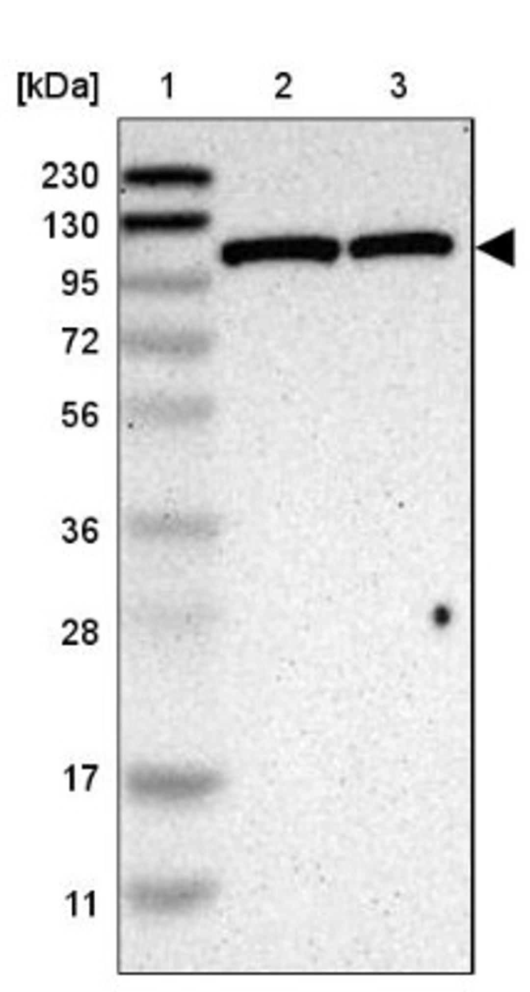 Western Blot: Hexokinase Antibody [NBP1-85789] - Lane 1: Marker [kDa] 230, 130, 95, 72, 56, 36, 28, 17, 11<br/>Lane 2: Human cell line RT-4<br/>Lane 3: Human cell line U-251MG sp