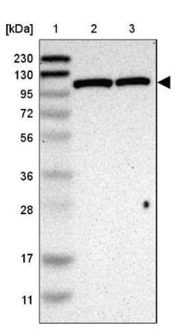 Western Blot: Hexokinase Antibody [NBP1-85789] - Lane 1: Marker [kDa] 230, 130, 95, 72, 56, 36, 28, 17, 11<br/>Lane 2: Human cell line RT-4<br/>Lane 3: Human cell line U-251MG sp