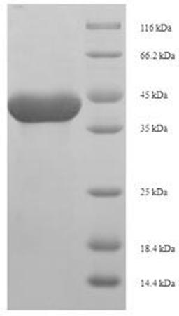 (Tris-Glycine gel) Discontinuous SDS-PAGE (reduced) with 5% enrichment gel and 15% separation gel.
