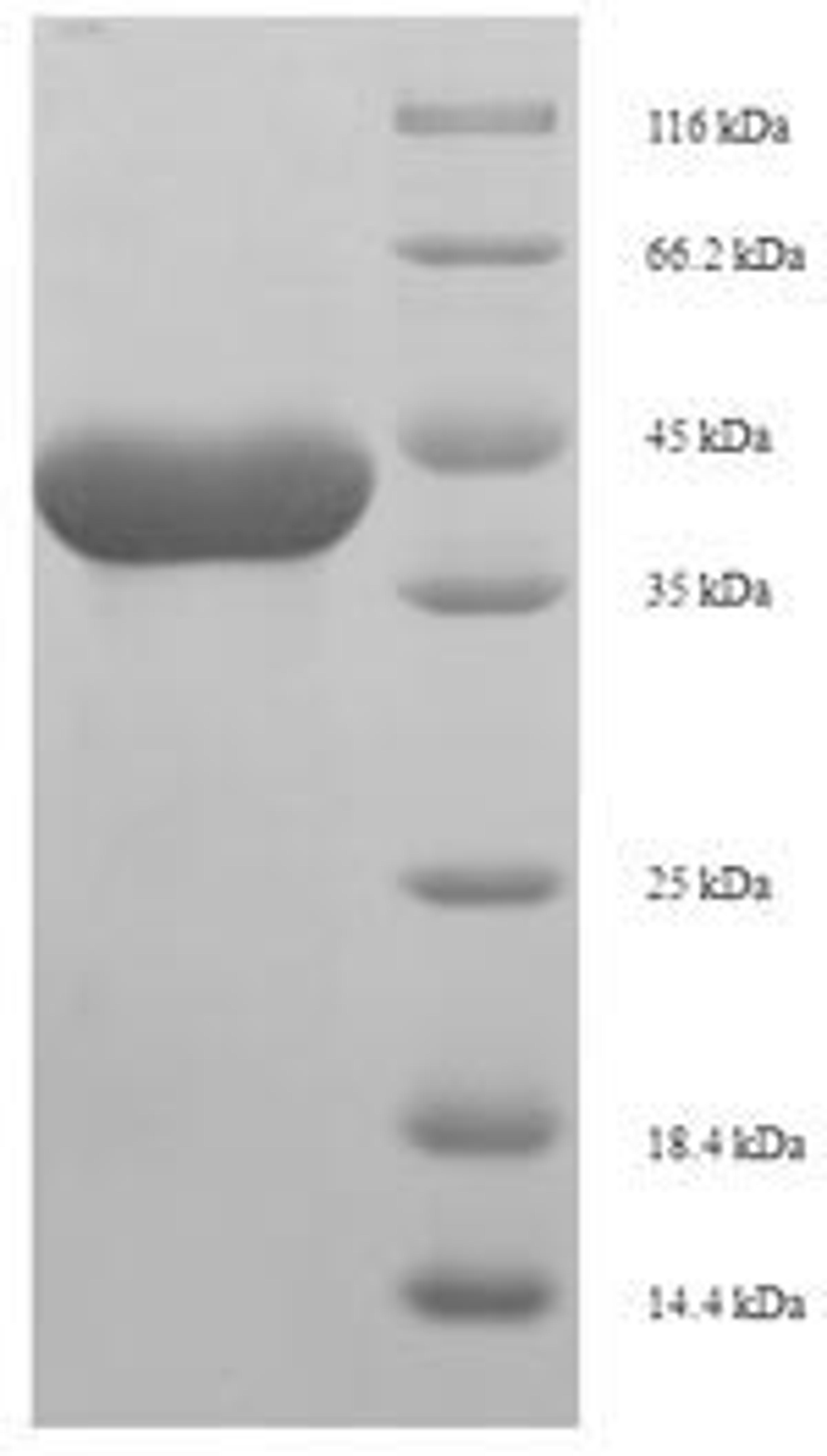 (Tris-Glycine gel) Discontinuous SDS-PAGE (reduced) with 5% enrichment gel and 15% separation gel.