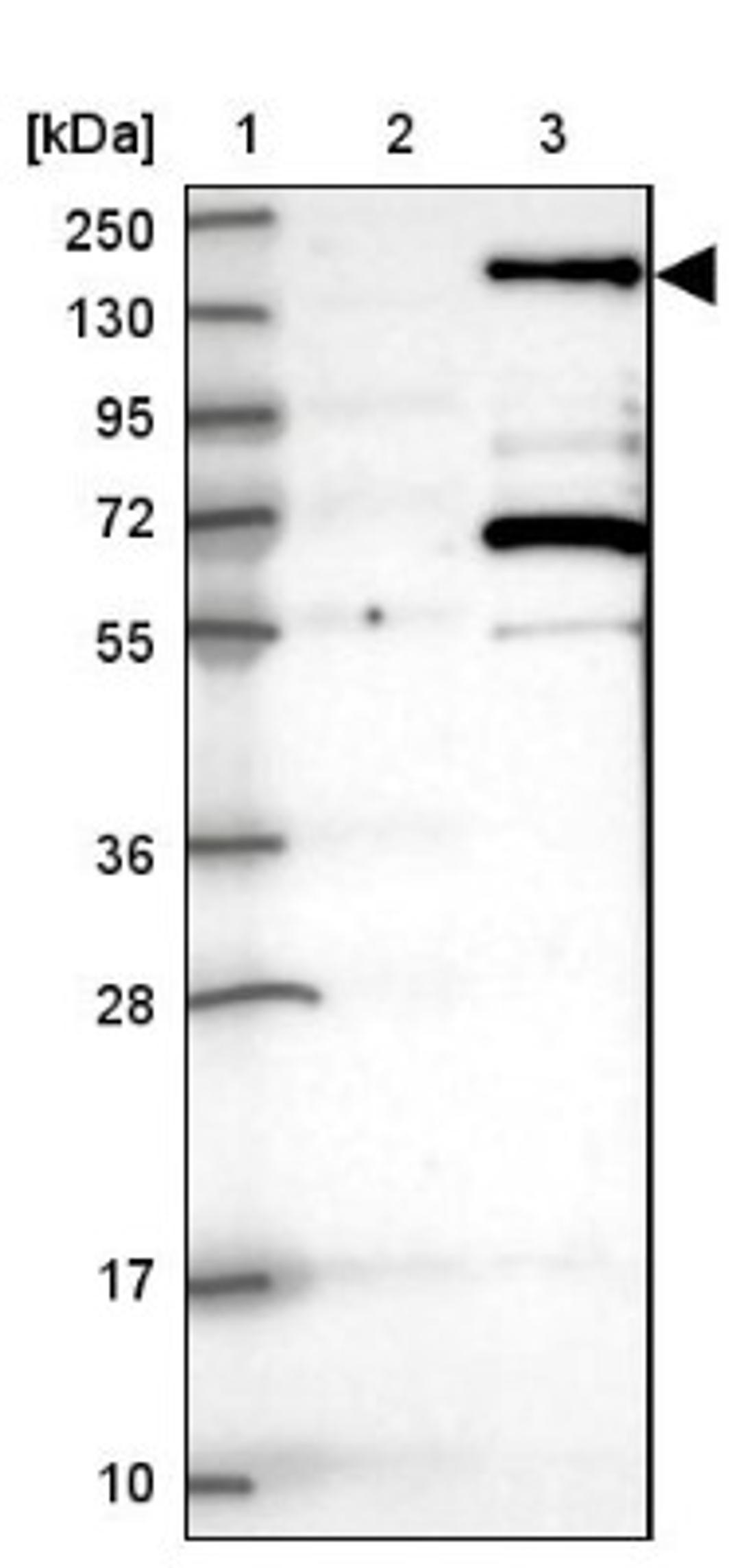 Western Blot: PTIP Antibody [NBP2-33877] - Lane 1: Marker [kDa] 250, 130, 95, 72, 55, 36, 28, 17, 10<br/>Lane 2: Negative control (vector only transfected HEK293T lysate)<br/>Lane 3: Over-expression lysate (Co-expressed with a C-terminal myc-DDK tag (~3.1 kDa) in mammalian HEK293T cells, LY402132)