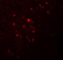 Immunocytochemistry/Immunofluorescence: TSPAN9 Antibody [NBP1-77098] - Immunofluorescence of TSPAN9 in human spleen tissue with TSPAN9 antibody at 20 ug/mL.