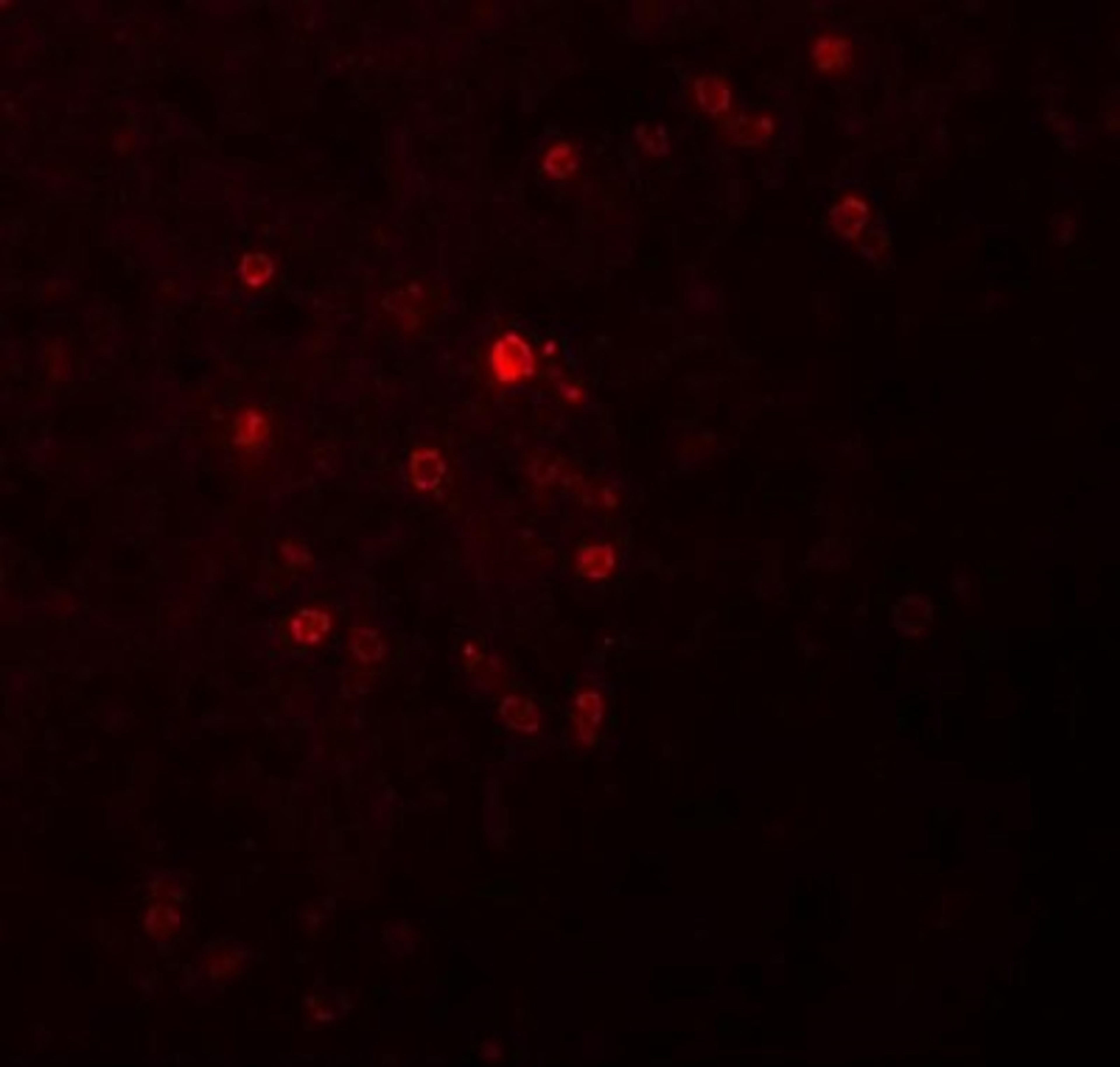 Immunocytochemistry/Immunofluorescence: TSPAN9 Antibody [NBP1-77098] - Immunofluorescence of TSPAN9 in human spleen tissue with TSPAN9 antibody at 20 ug/mL.