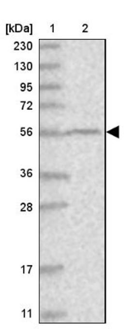 Immunohistochemistry: ZNF404 Antibody [NBP1-90916] - Lane 1: Marker [kDa] 230, 130, 95, 72, 56, 36, 28, 17, 11<br/>Lane 2: Human cell line RT-4