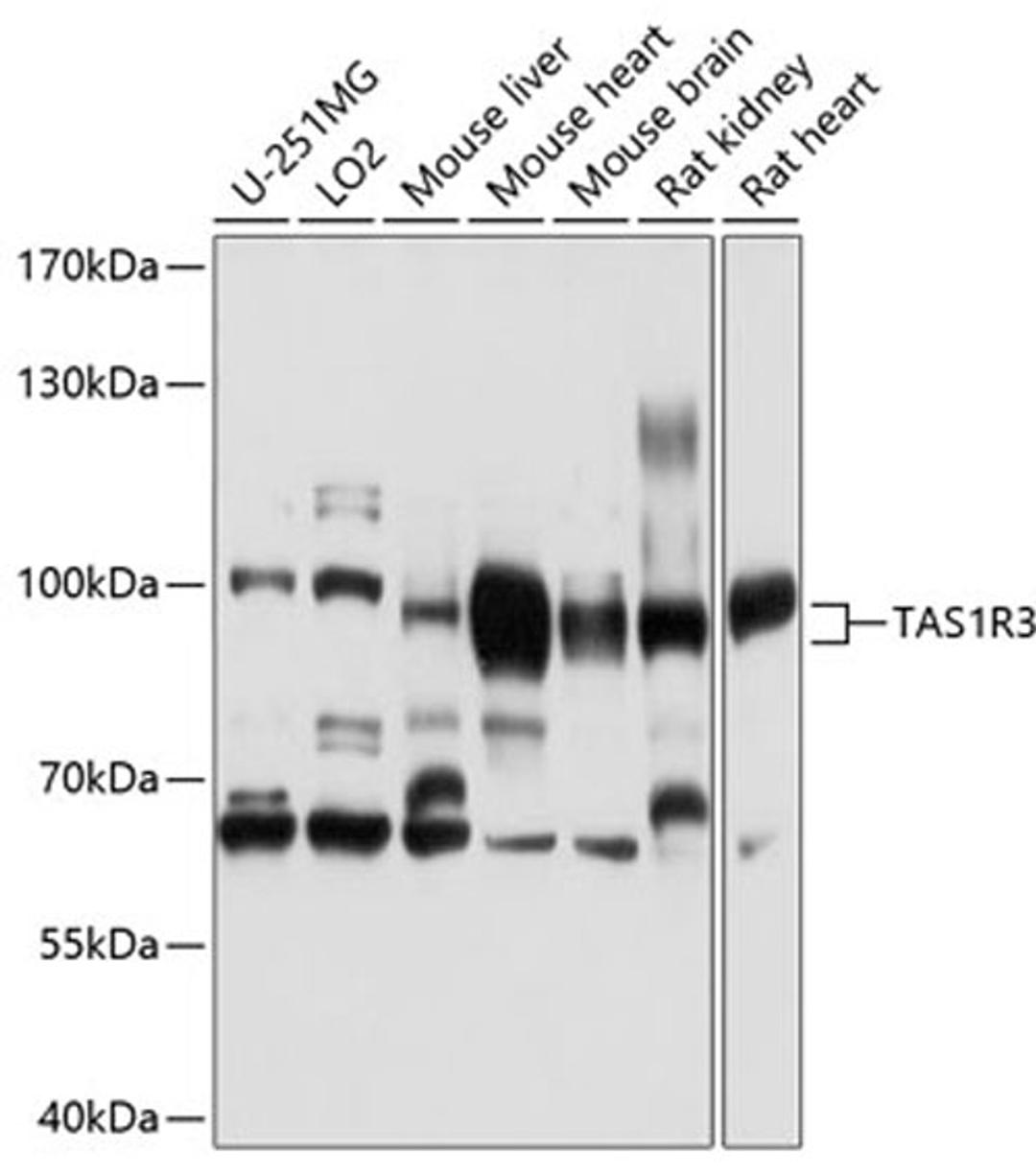 Western blot - TAS1R3 antibody (A10157)