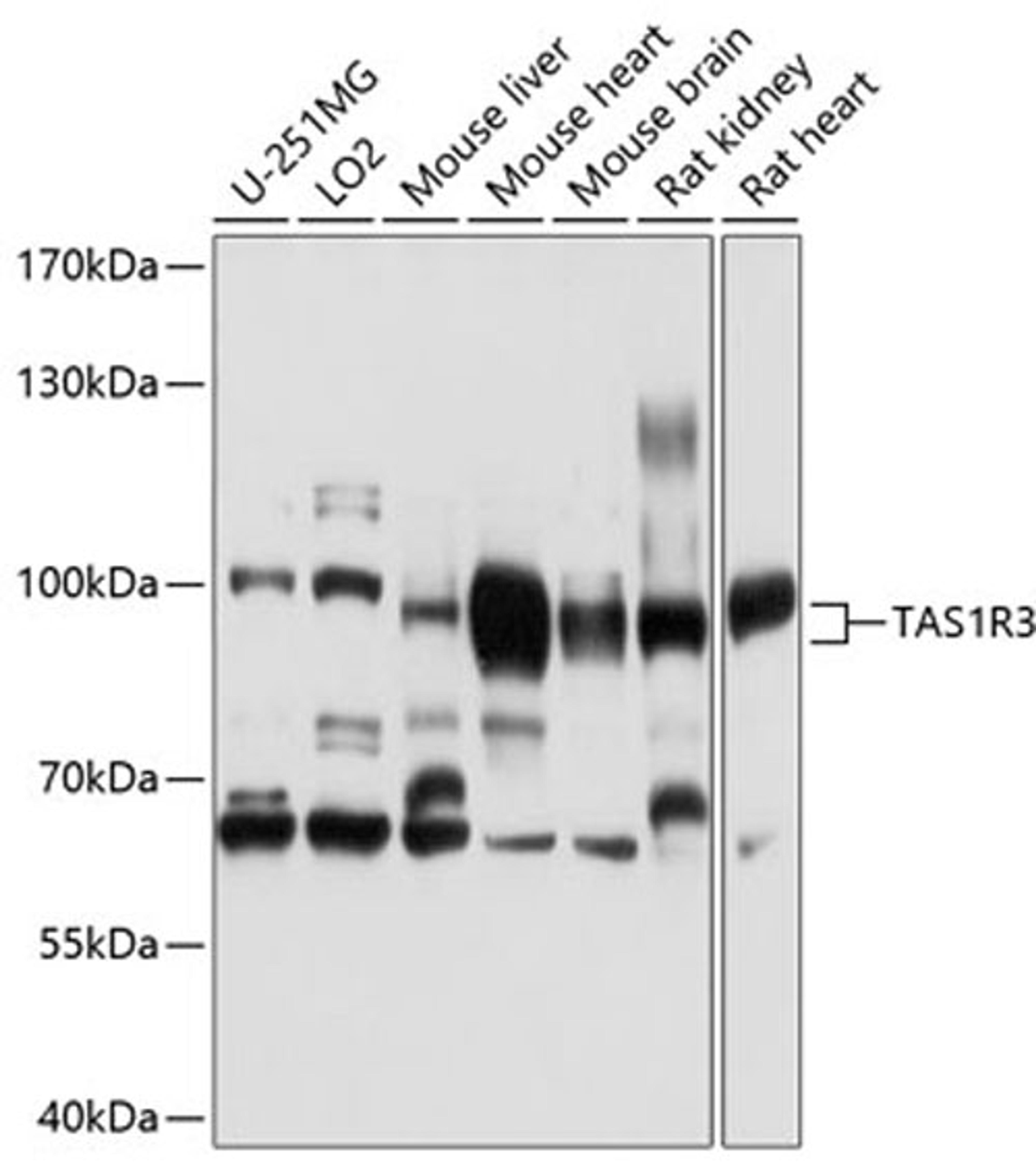 Western blot - TAS1R3 antibody (A10157)