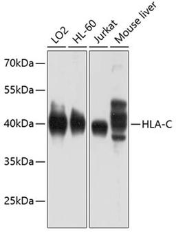 Western blot - HLA-C antibody (A1013)