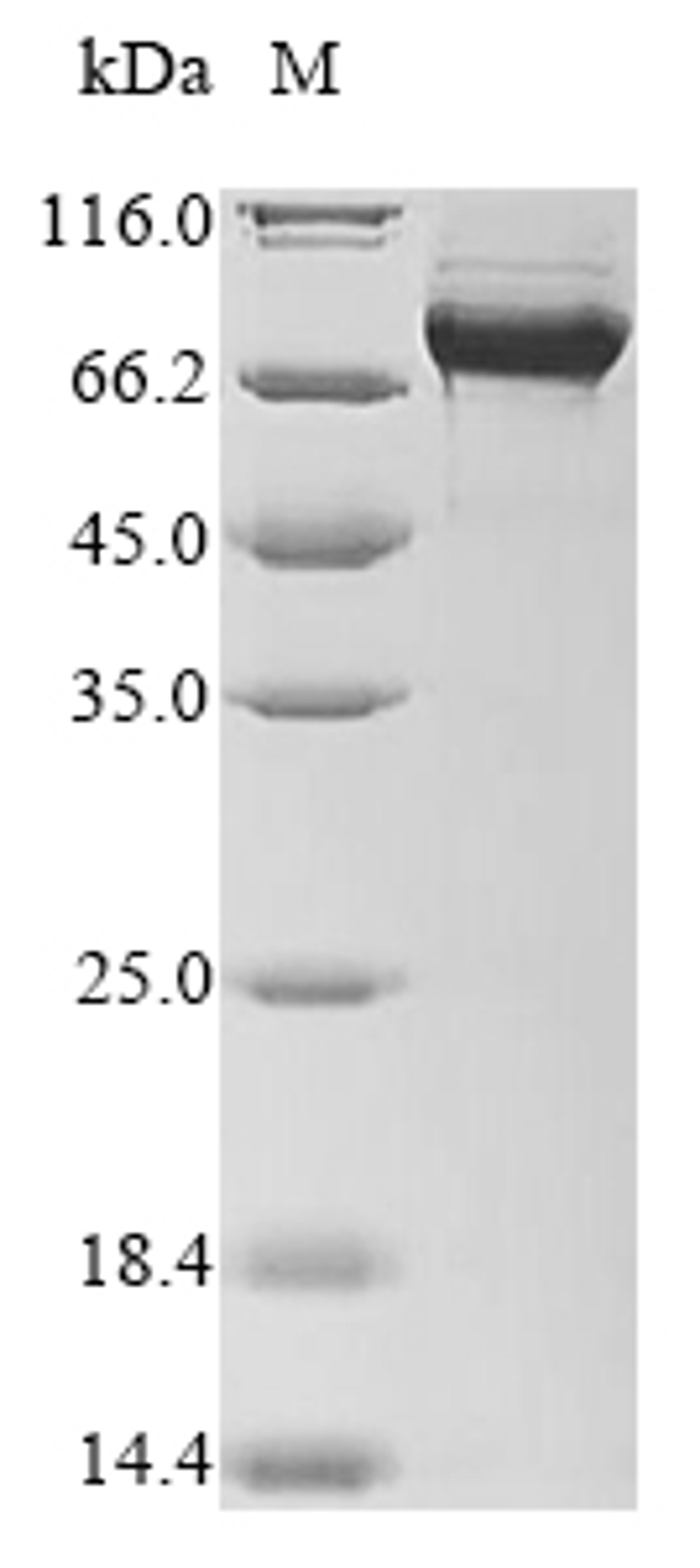 (Tris-Glycine gel) Discontinuous SDS-PAGE (reduced) with 5% enrichment gel and 15% separation gel.