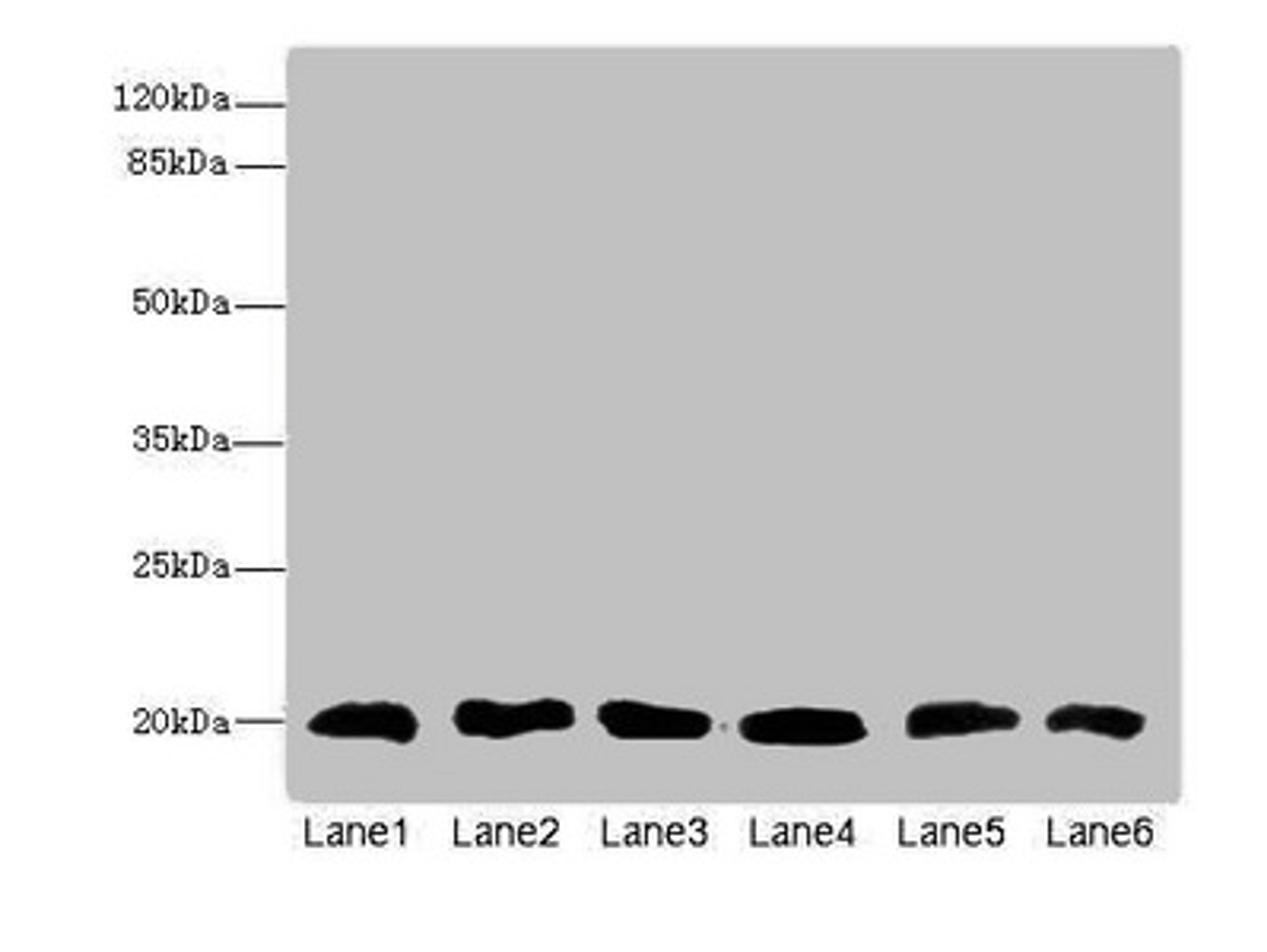 Western blot. All lanes: CFL2 antibody at 3.75µg/ml. Lane 1: Mouse brain tissue. Lane 2: Mouse liver tissue. Lane 3: Mouse lung tissue. Lane 4: LO2 whole cell lysate. Lane 5: Hela whole cell lysate. Lane 6: A549 whole cell lysate. Secondary. Goat polyclonal to rabbit IgG at 1/10000 dilution. Predicted band size: 19, 17 kDa. Observed band size: 19 kDa