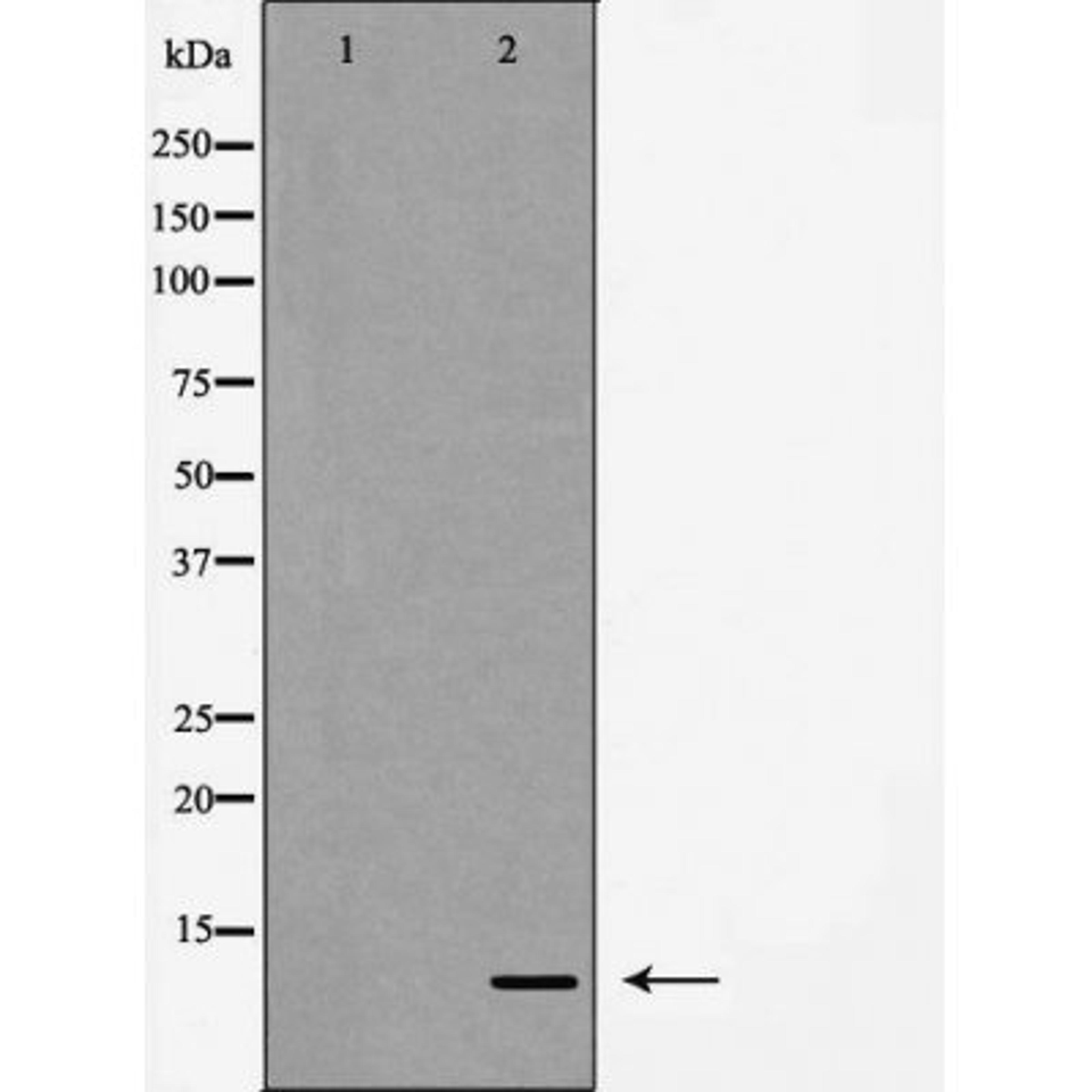 Western blot analysis of HeLa cells using Interleukin 8 antibody