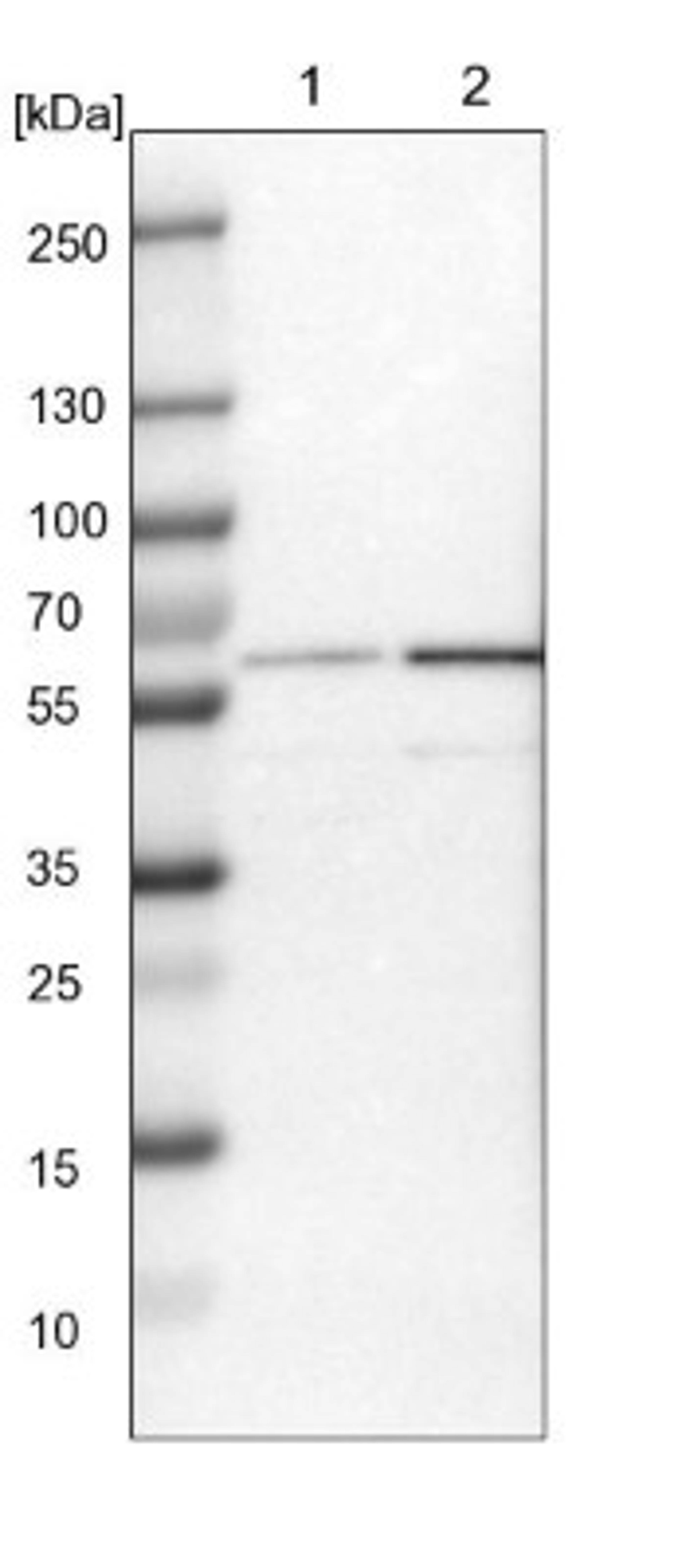 Western Blot: PRPF4 Antibody [NBP1-83217] - Lane 1: NIH-3T3 cell lysate (Mouse embryonic fibroblast cells)<br/>Lane 2: NBT-II cell lysate (Rat Wistar bladder tumour cells)