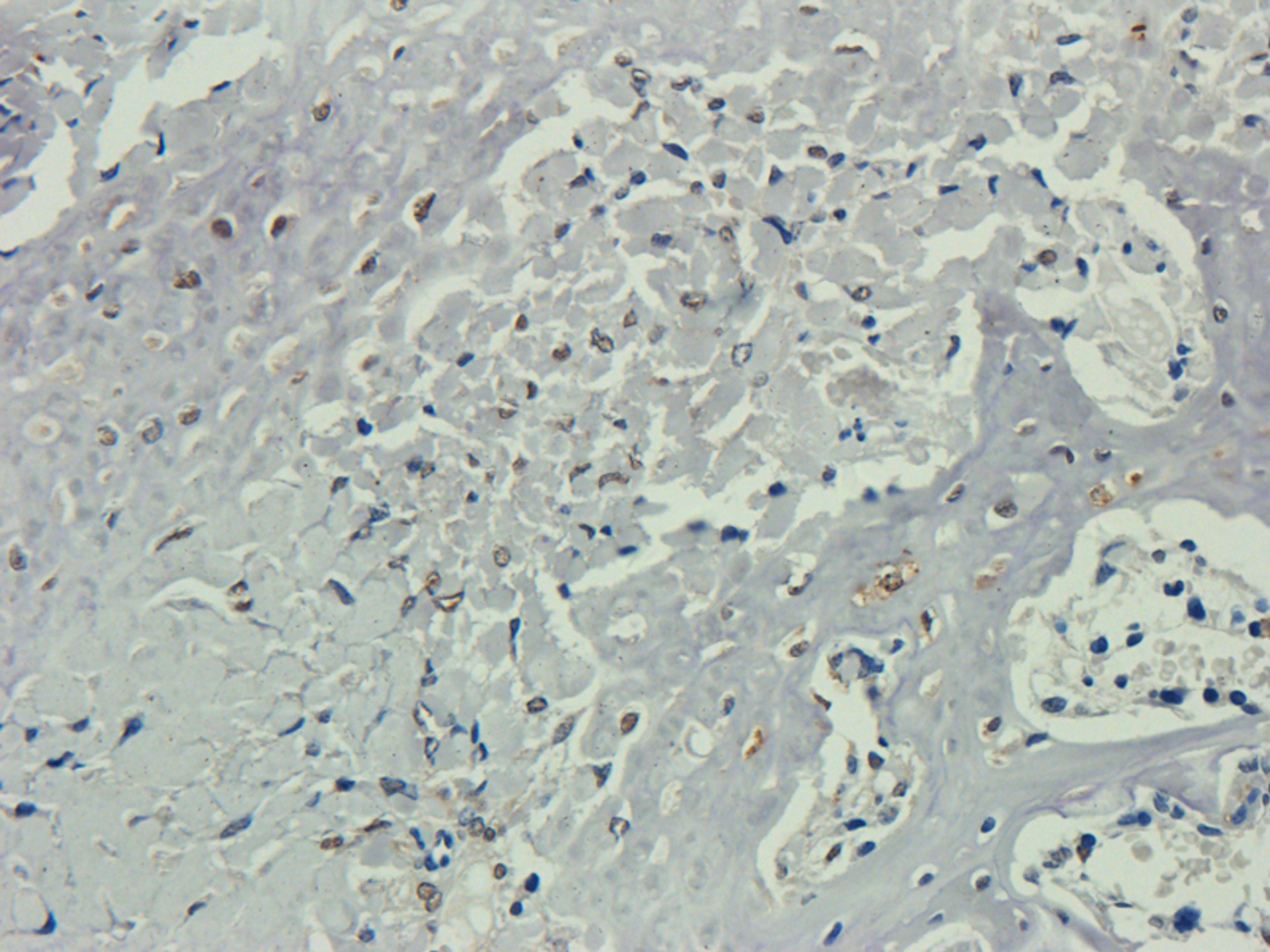 IHC-P staining of rat bone marrow tissue using Nestin antibody (2.5 ug/ml)