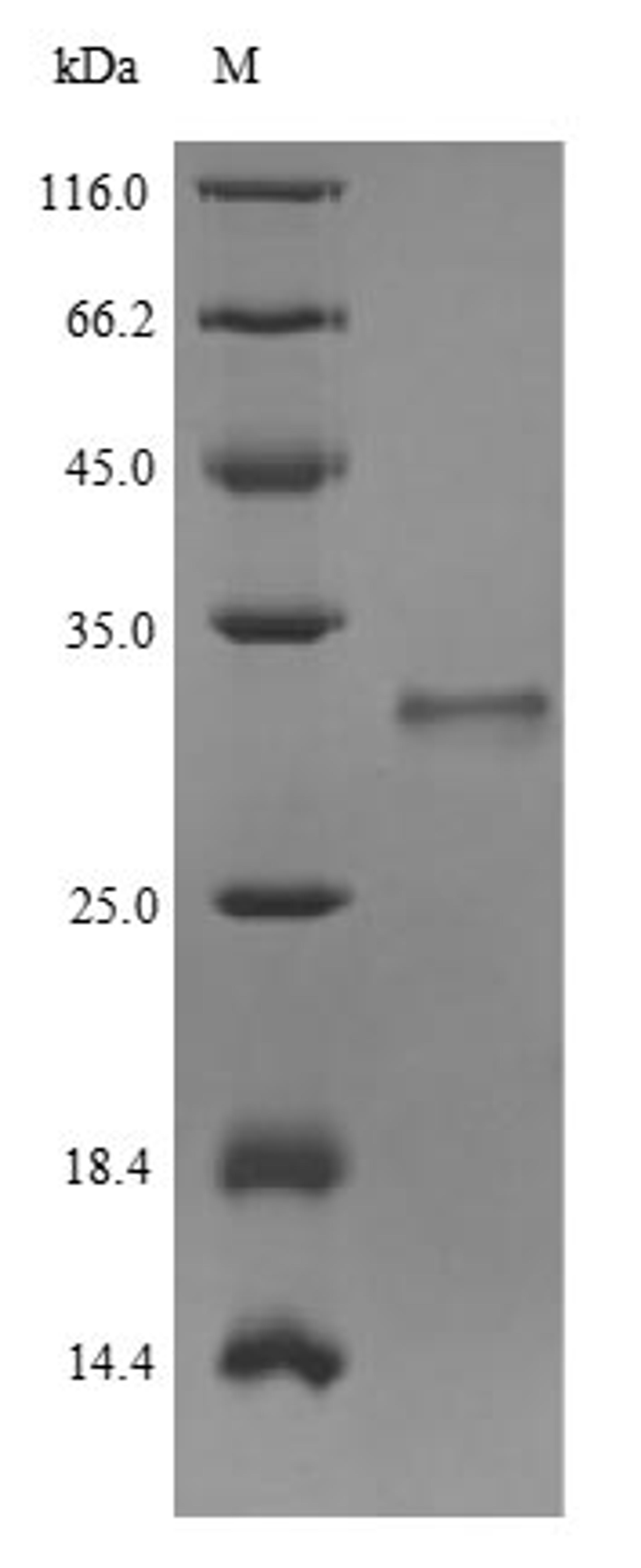 (Tris-Glycine gel) Discontinuous SDS-PAGE (reduced) with 5% enrichment gel and 15% separation gel.