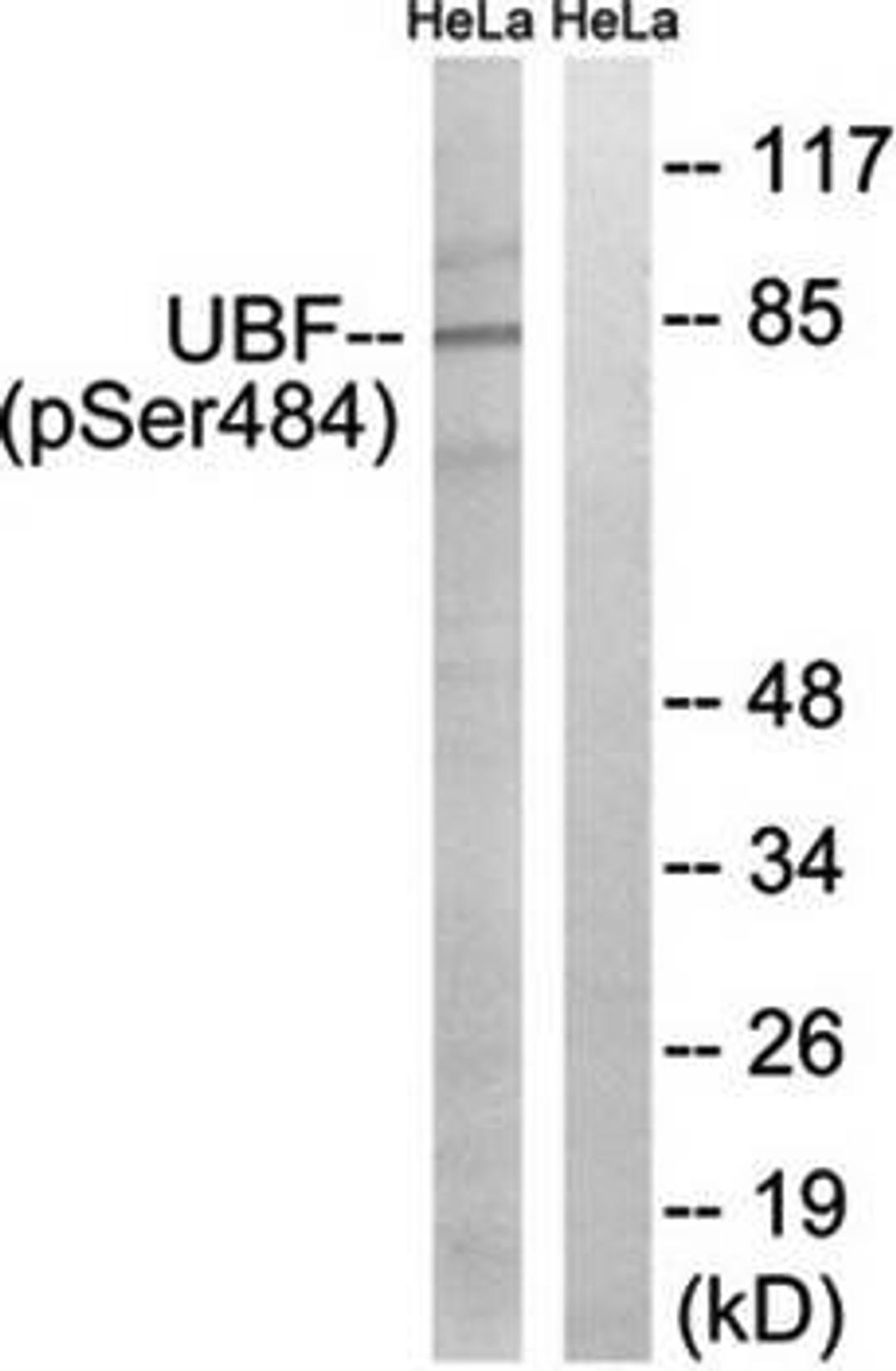 Western blot analysis of extracts from HeLa cells using UBF (phospho-Ser484) antibody