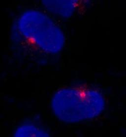 Detection of human CEP290 by immunocytochemistry.