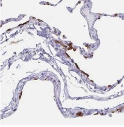 Immunohistochemistry-Paraffin: SLC34A2 Antibody [NBP1-81013] - Human lung.