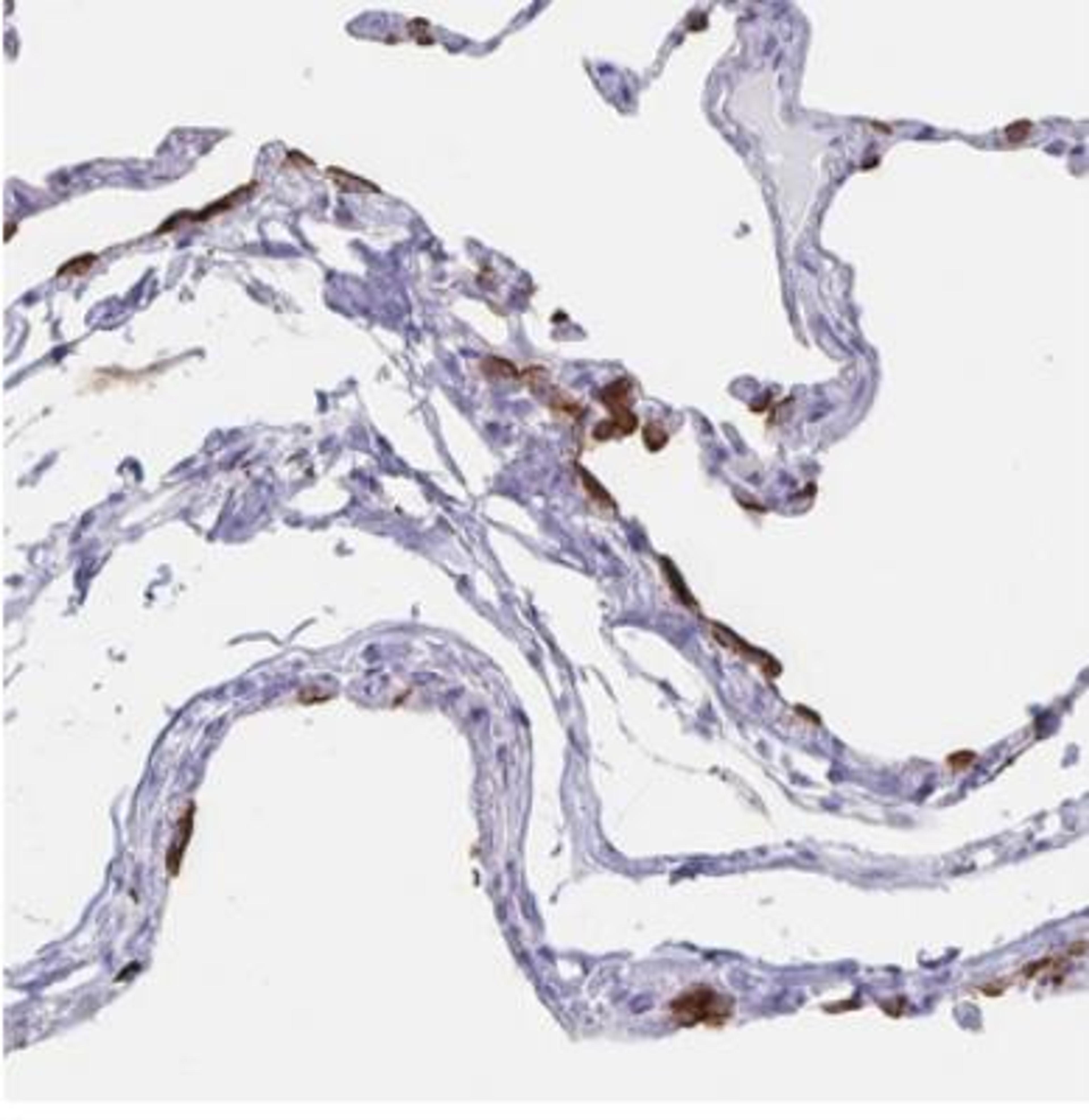 Immunohistochemistry-Paraffin: SLC34A2 Antibody [NBP1-81013] - Human lung.