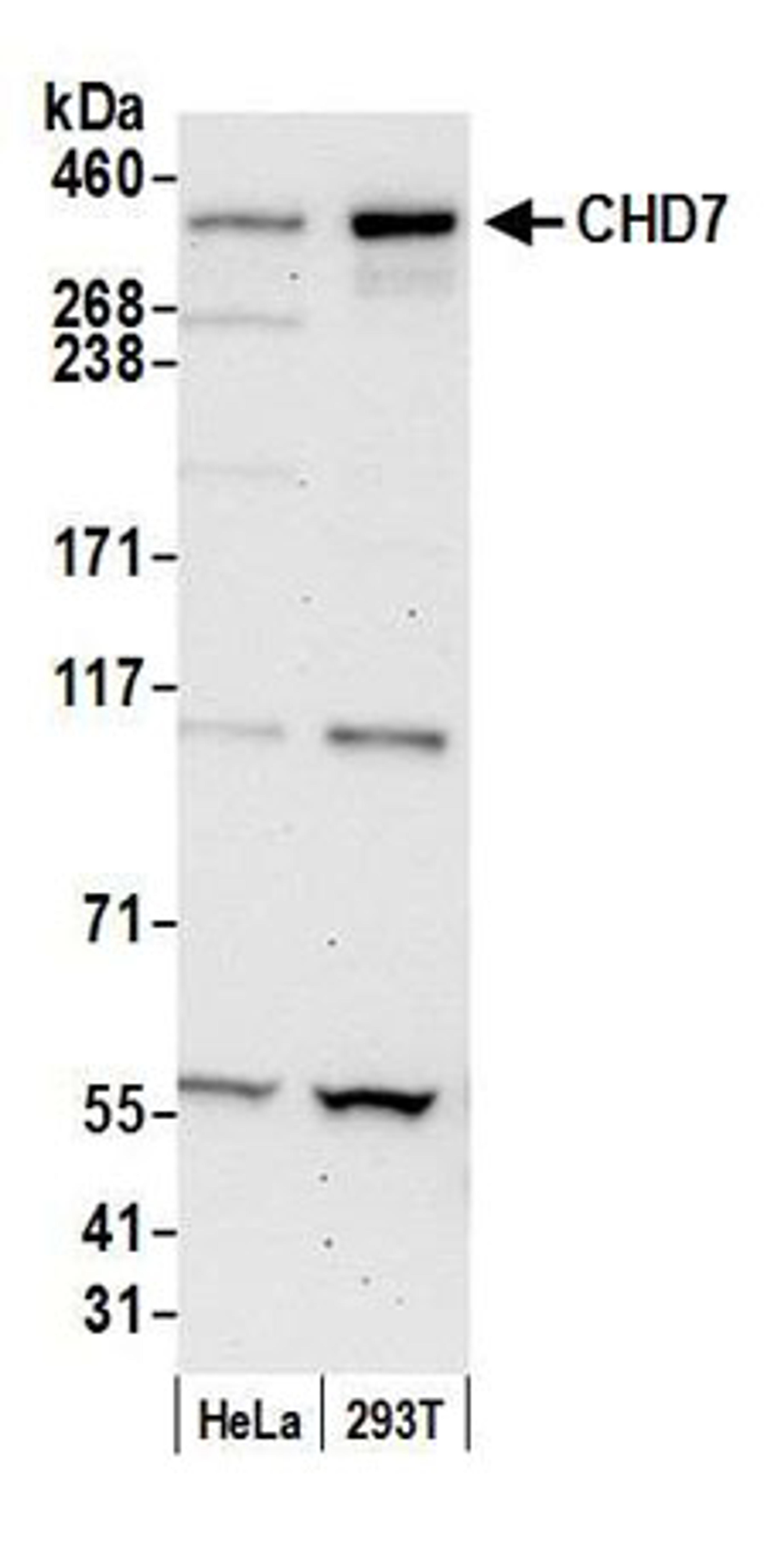 Detection of human CHD7 by western blot.