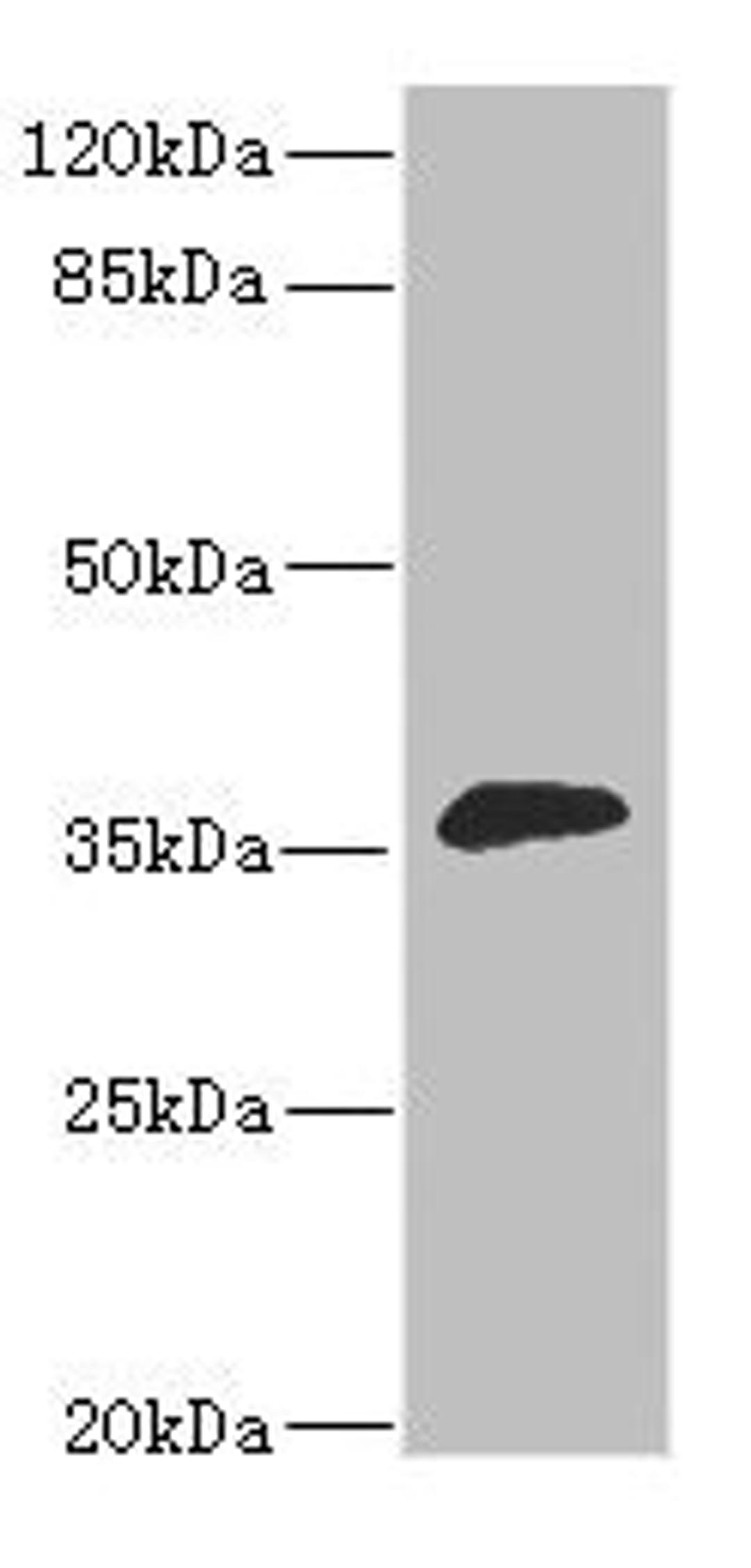 Western blot. All lanes: DHDH antibody at 1.4ug/ml + Mouse liver tissue. Secondary. Goat polyclonal to rabbit IgG at 1/10000 dilution. Predicted band size: 36 kDa. Observed band size: 36 kDa.