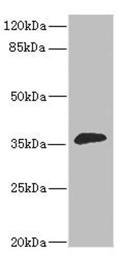 Western blot. All lanes: DHDH antibody at 1.4ug/ml + Mouse liver tissue. Secondary. Goat polyclonal to rabbit IgG at 1/10000 dilution. Predicted band size: 36 kDa. Observed band size: 36 kDa.