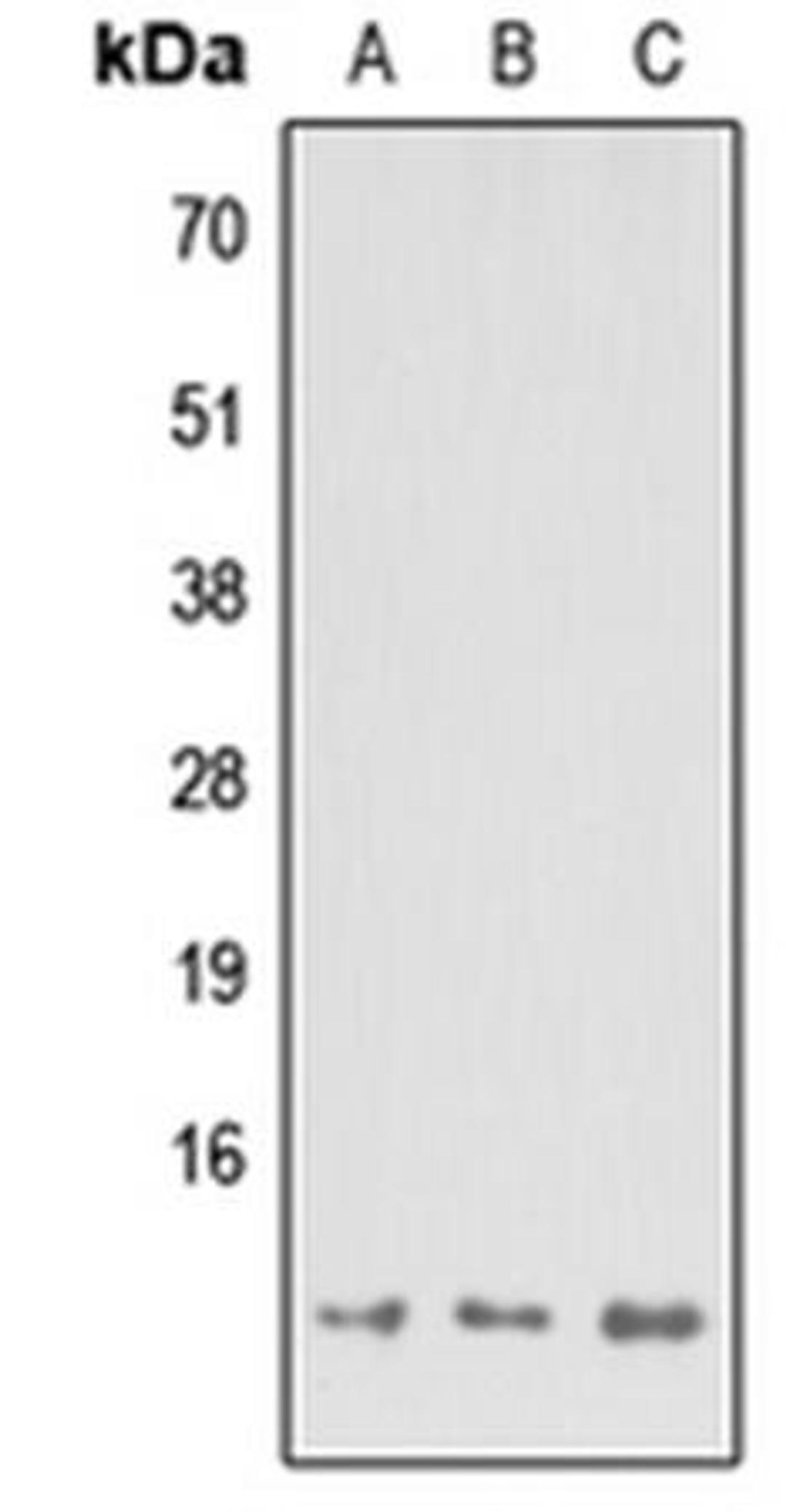 Western blot analysis of HEK293T (Lane1), Raw264.7 (Lane2), H9C2 (Lane3) whole cell using MP68 antibody